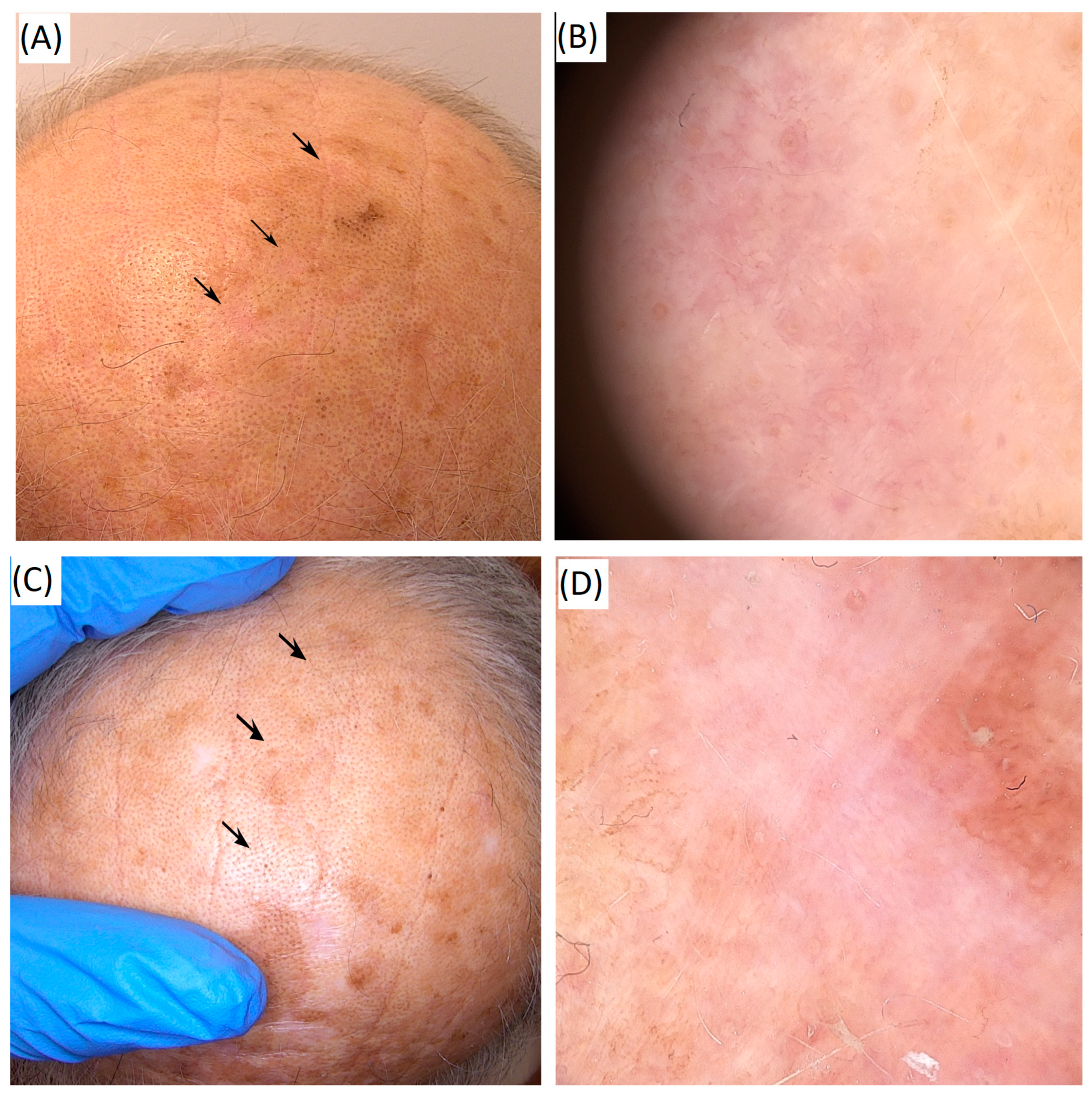 Cancers 17 03518 g003