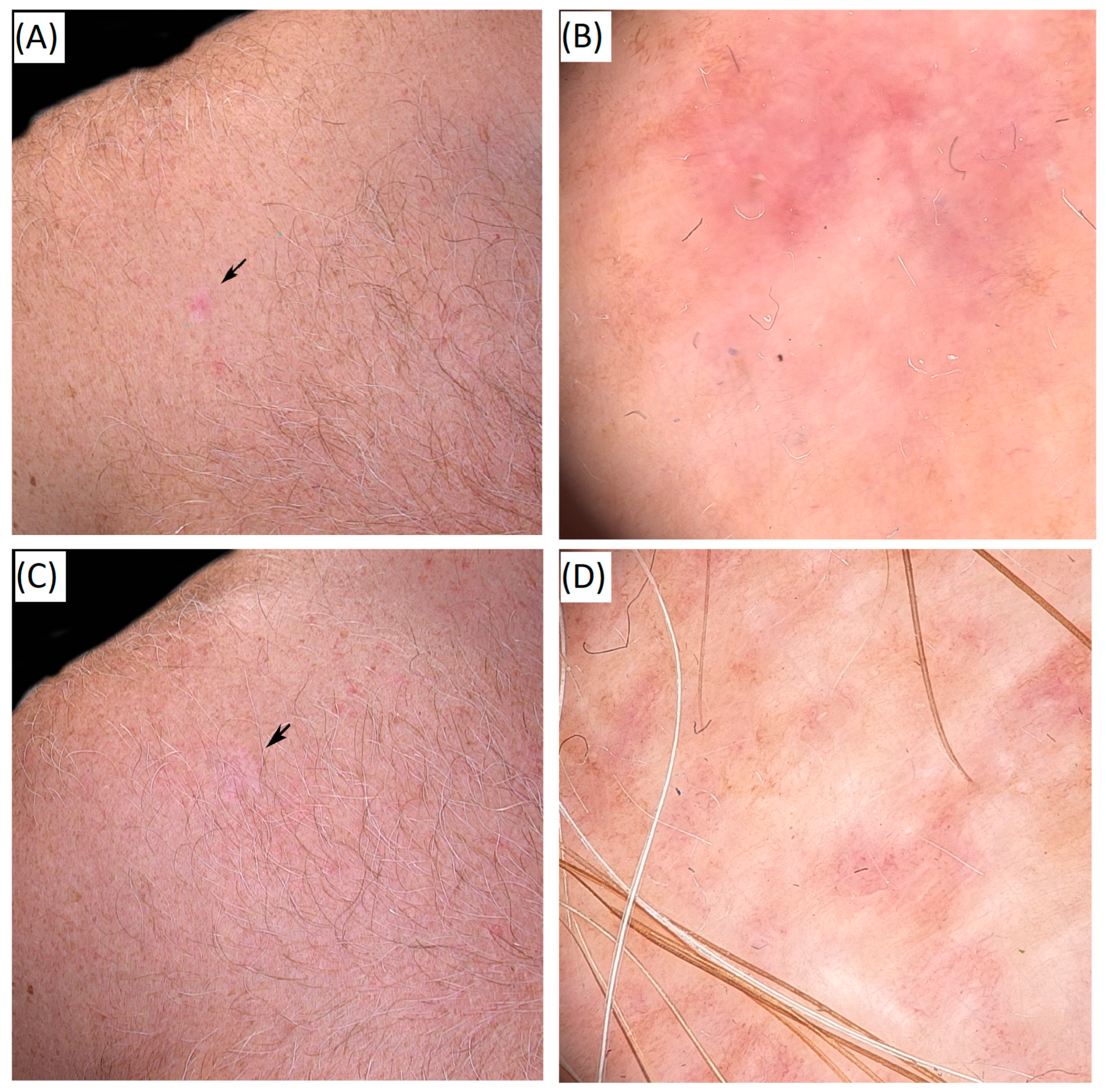 Cancers 17 03518 g004