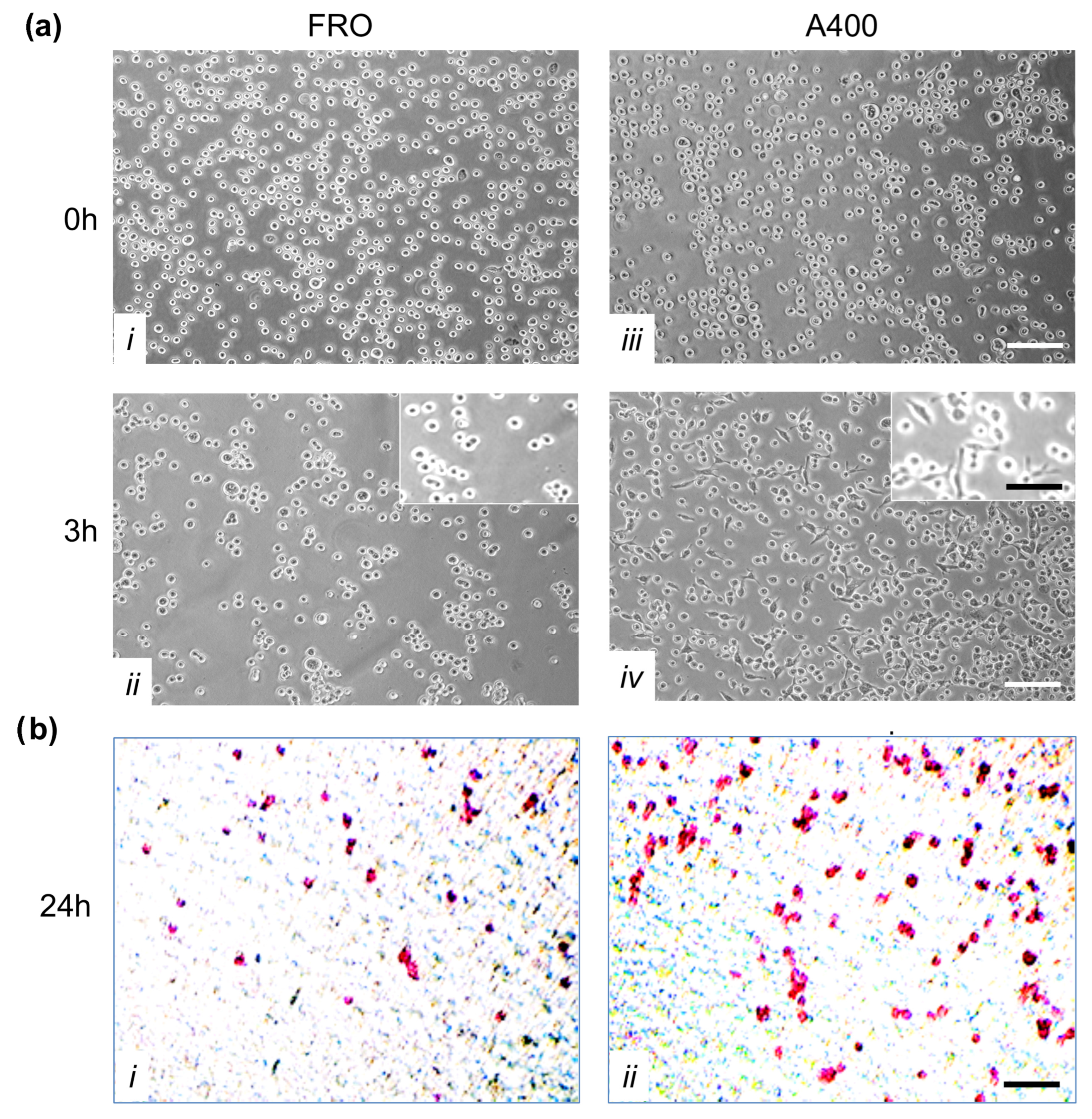 Cancers 17 03534 g007