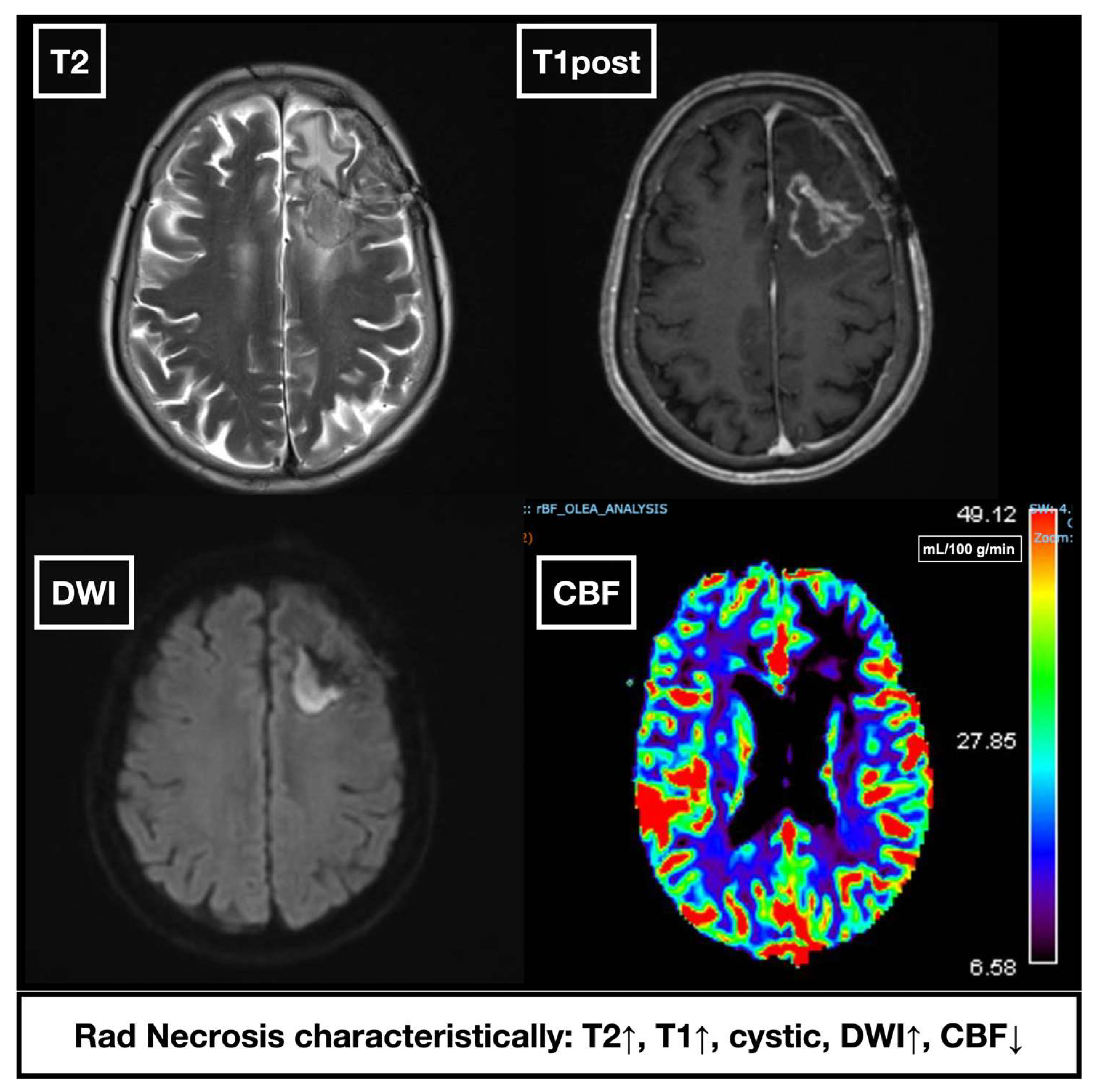 Cancers 17 03542 g002