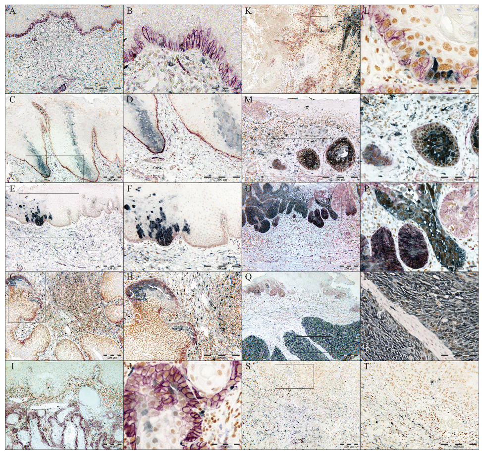 Cancers 17 03547 g002 Cancers 17 03547 g002