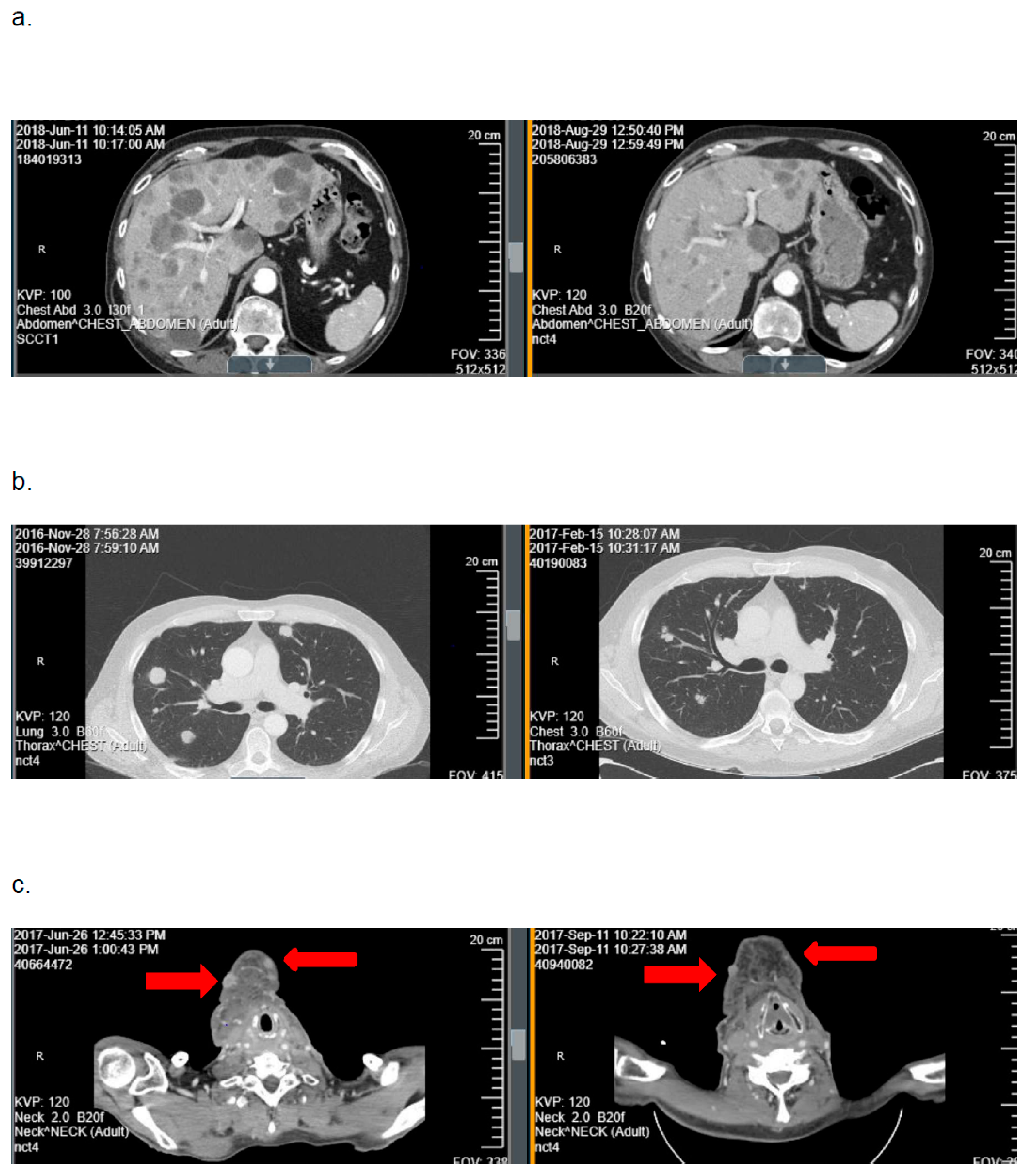 Cancers 17 03568 g002 Cancers 17 03568 g002