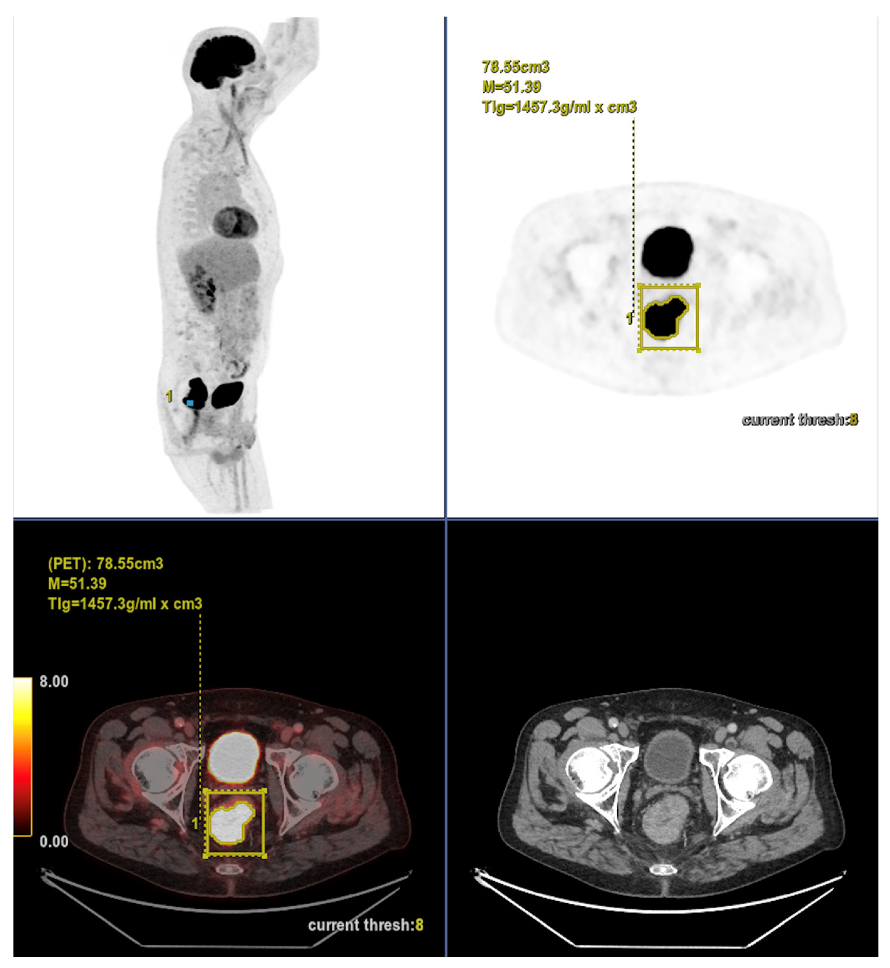 Cancers 17 03592 g007