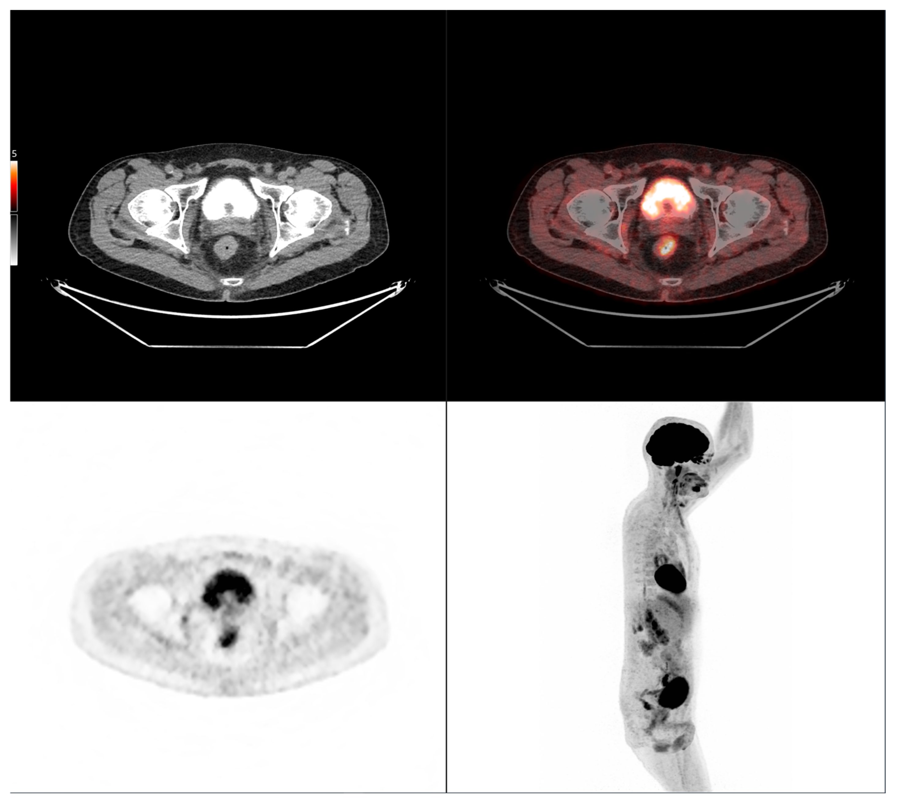 Cancers 17 03592 i003