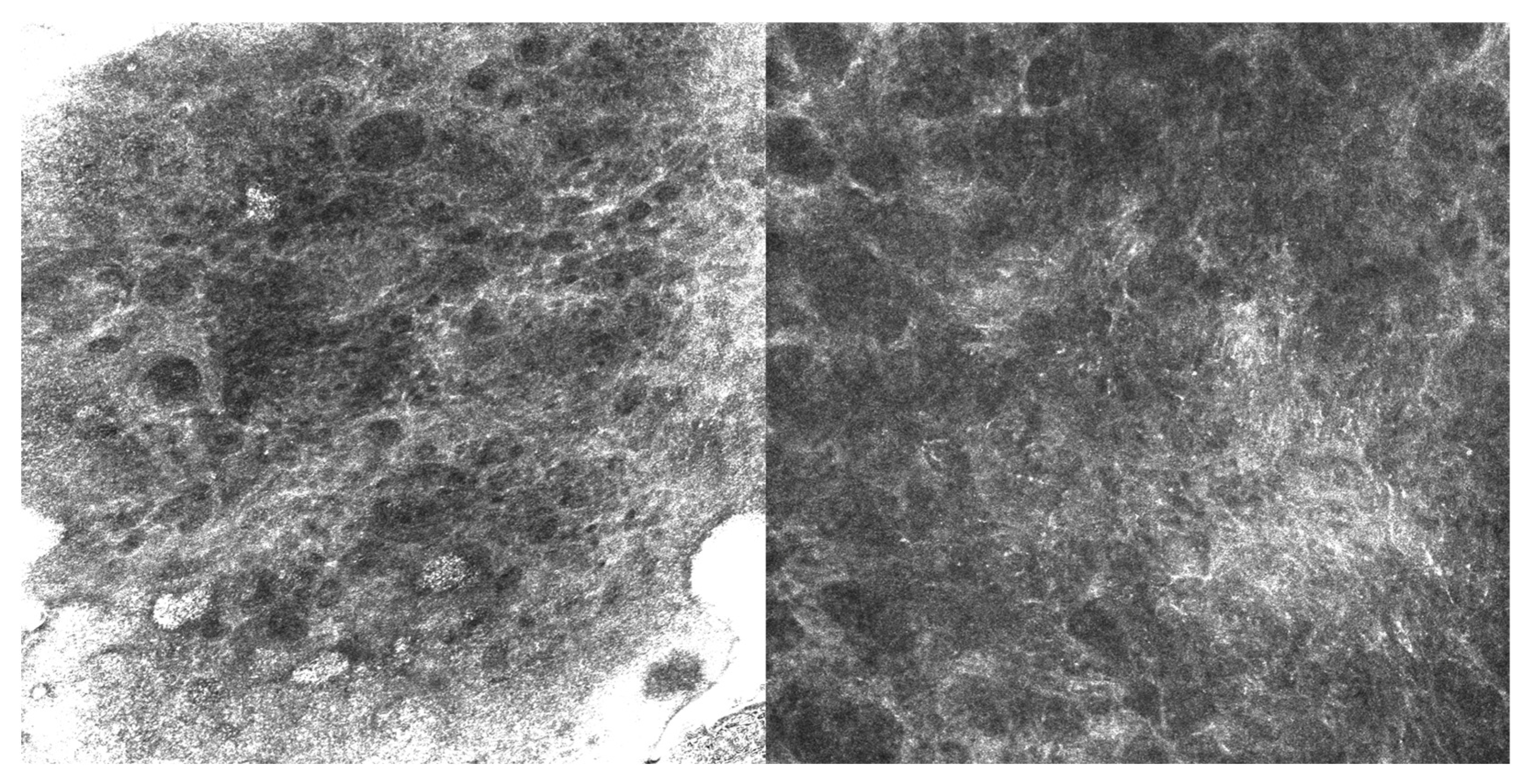 Cancers 17 03594 g002 Cancers 17 03594 g002