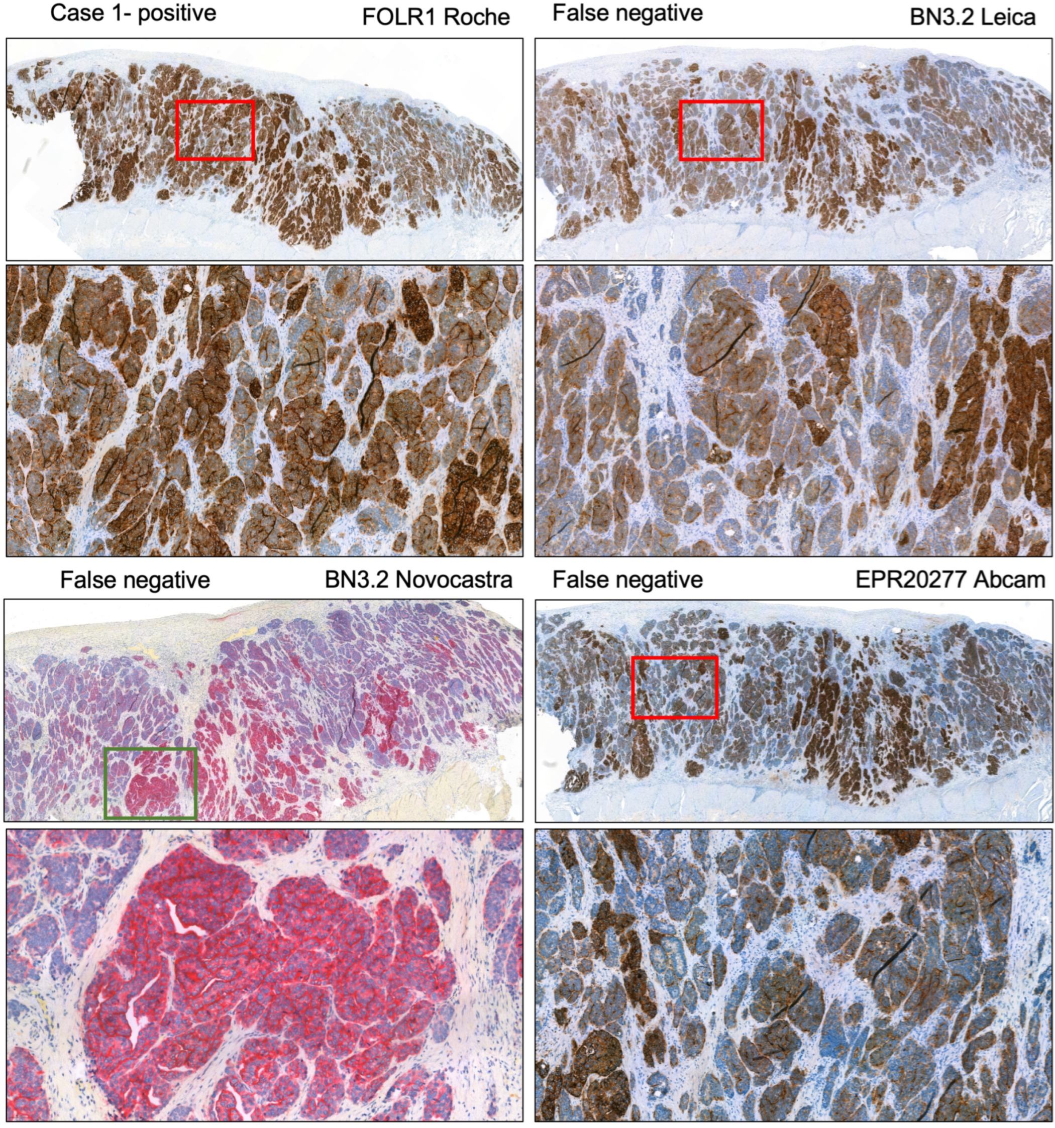 Cancers 17 03703 g004