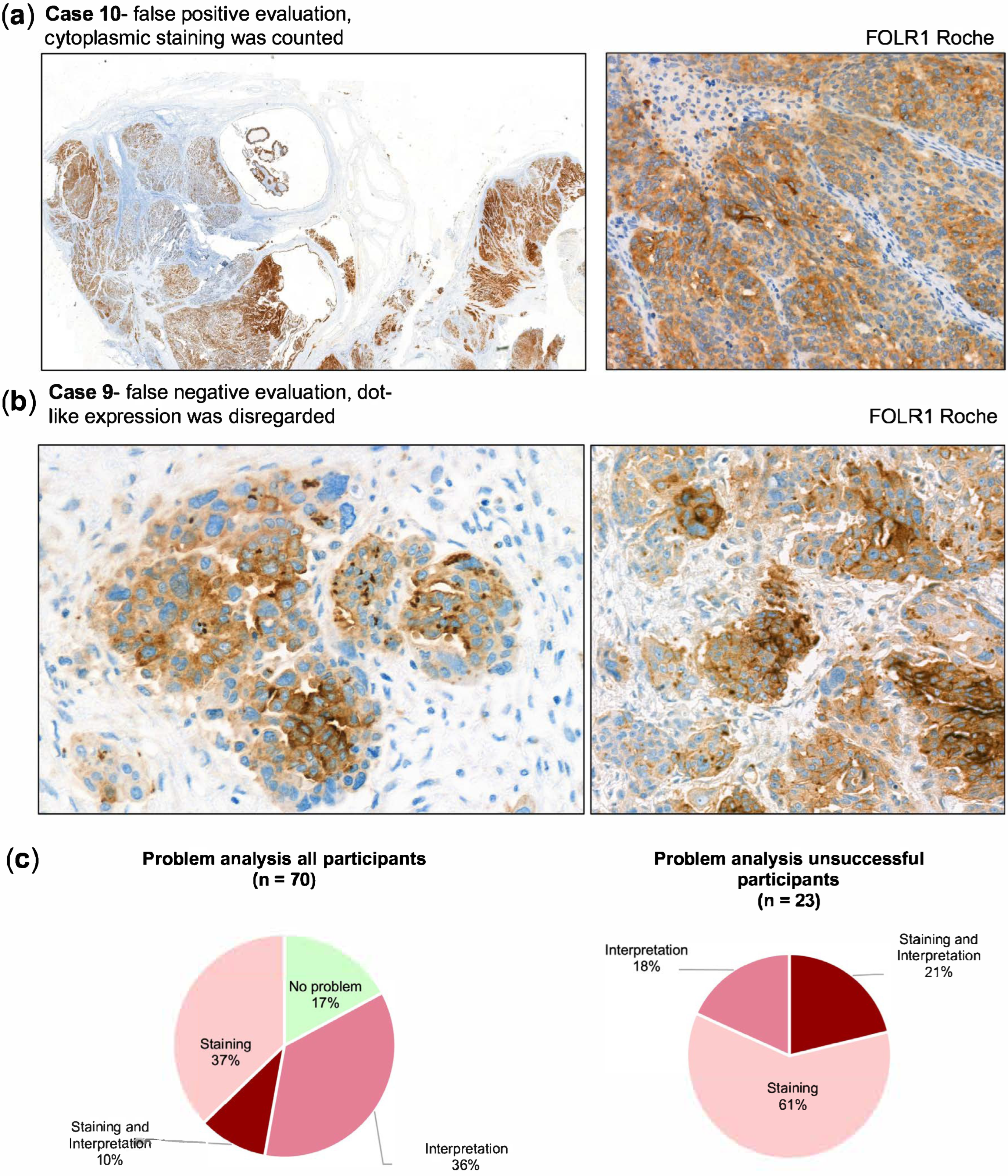 Cancers 17 03703 g005