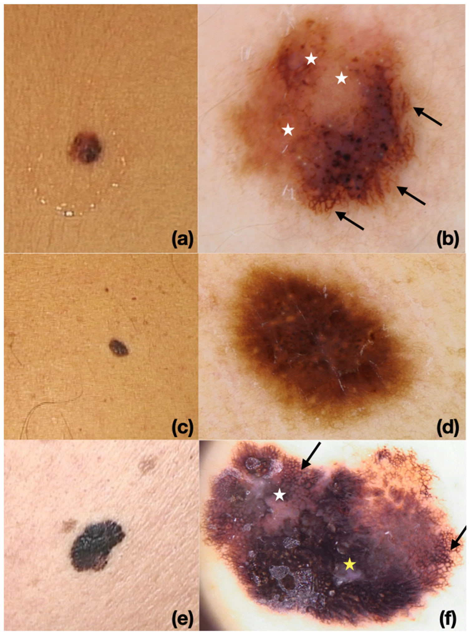 Cancers 17 03859 g002