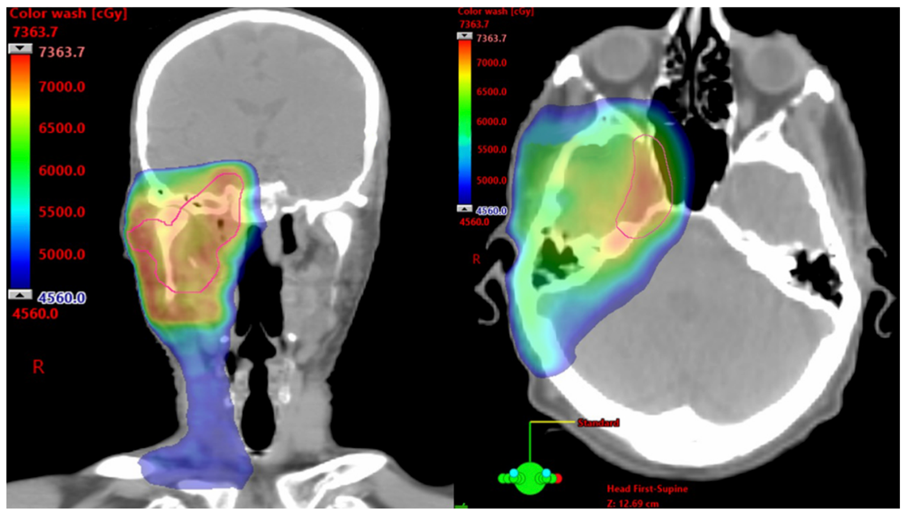 Cancers 17 03921 g001 Cancers 17 03921 g001