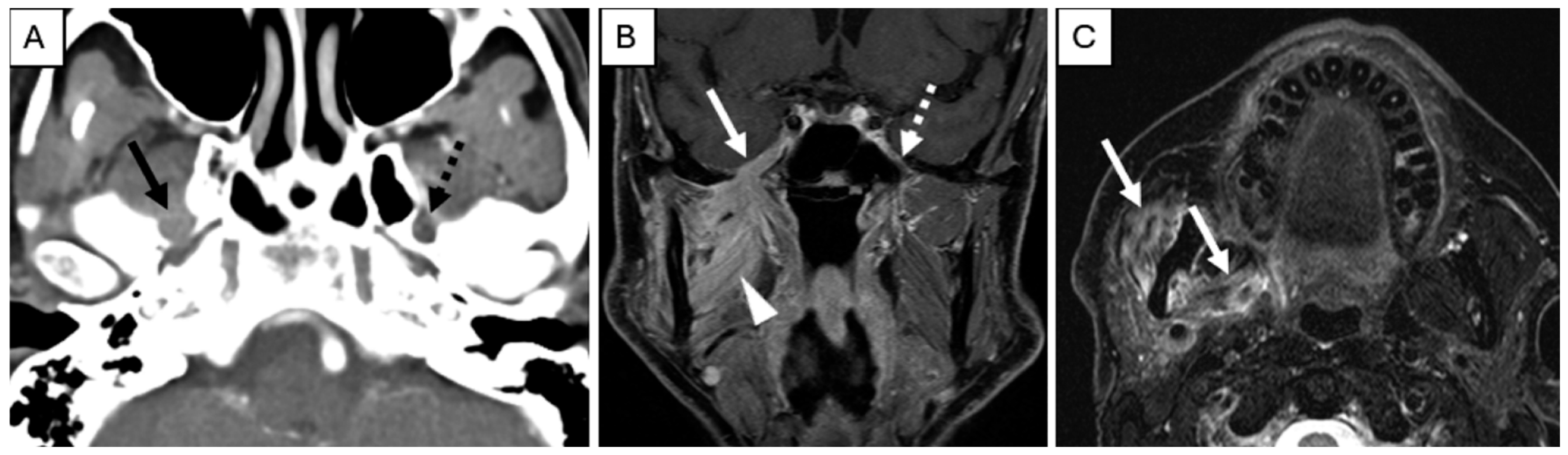 Cancers 17 03921 g002 Cancers 17 03921 g002