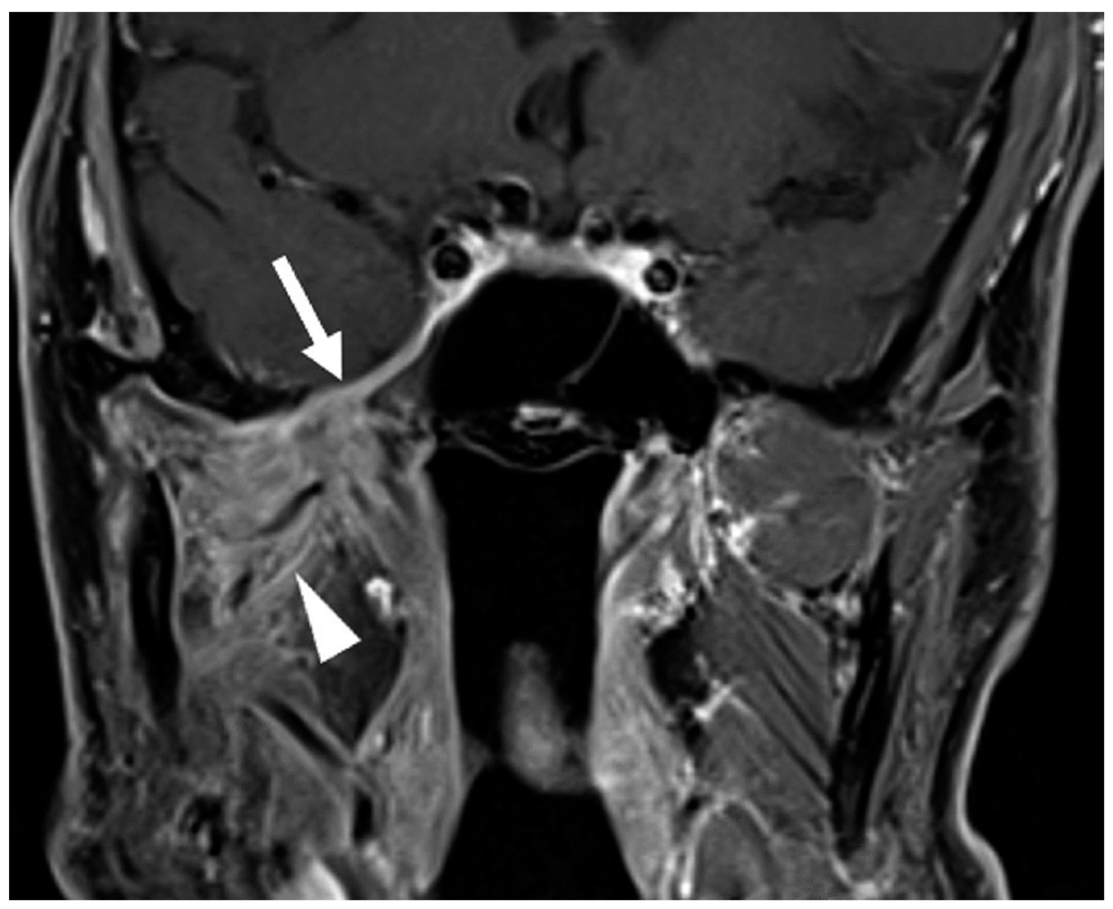 Cancers 17 03921 g003 Cancers 17 03921 g003