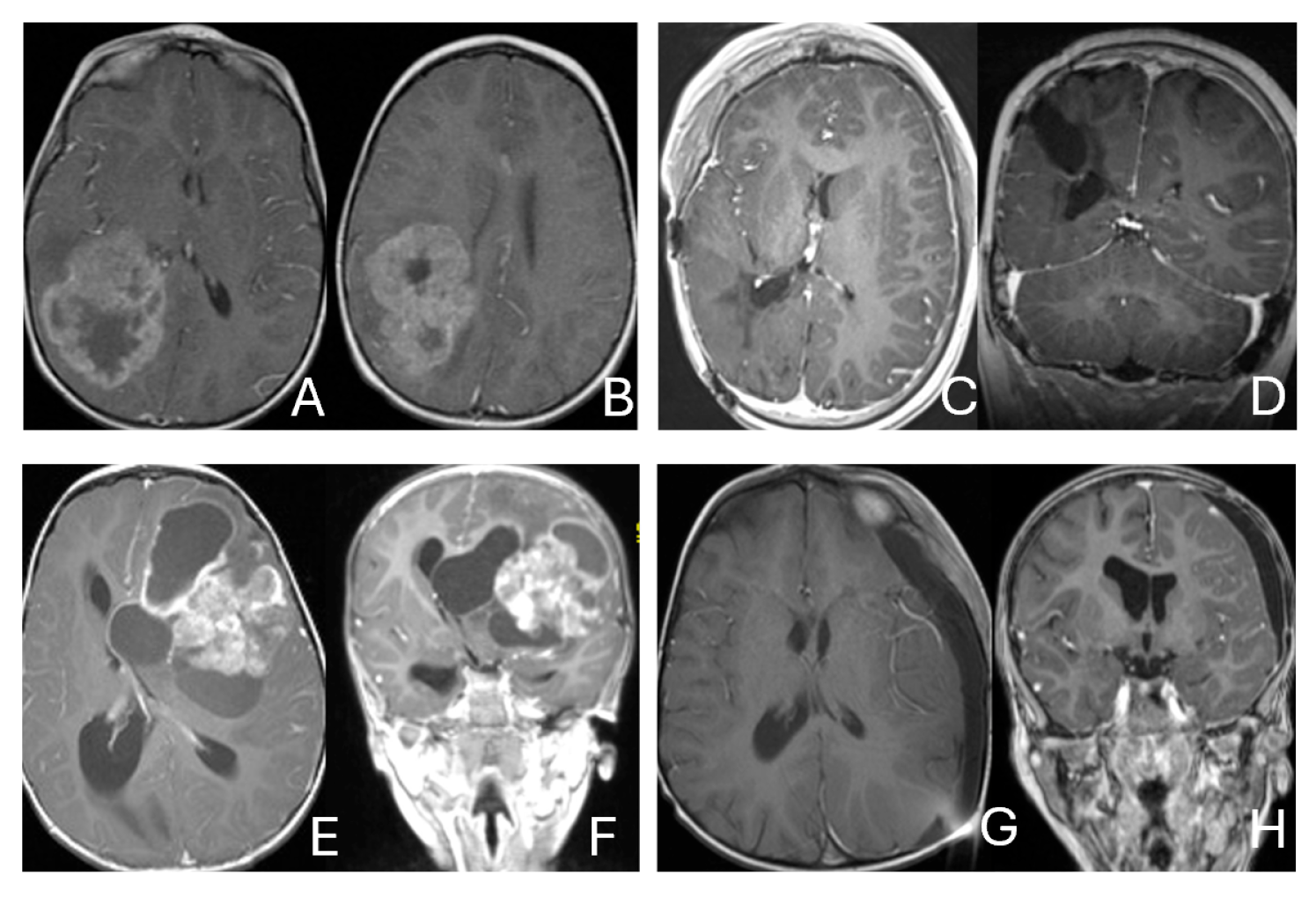 Cancers 18 00008 g001