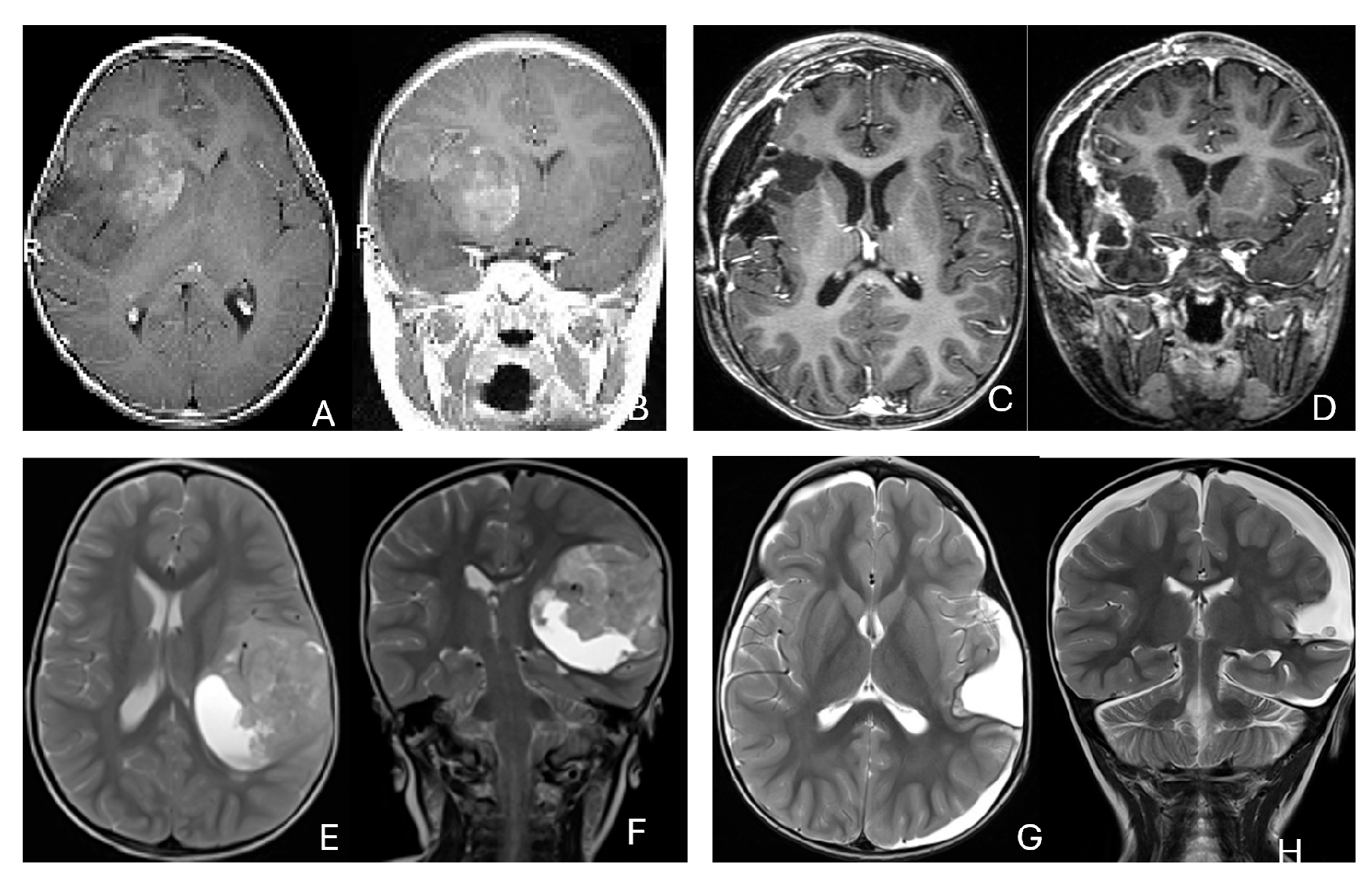 Cancers 18 00008 g002