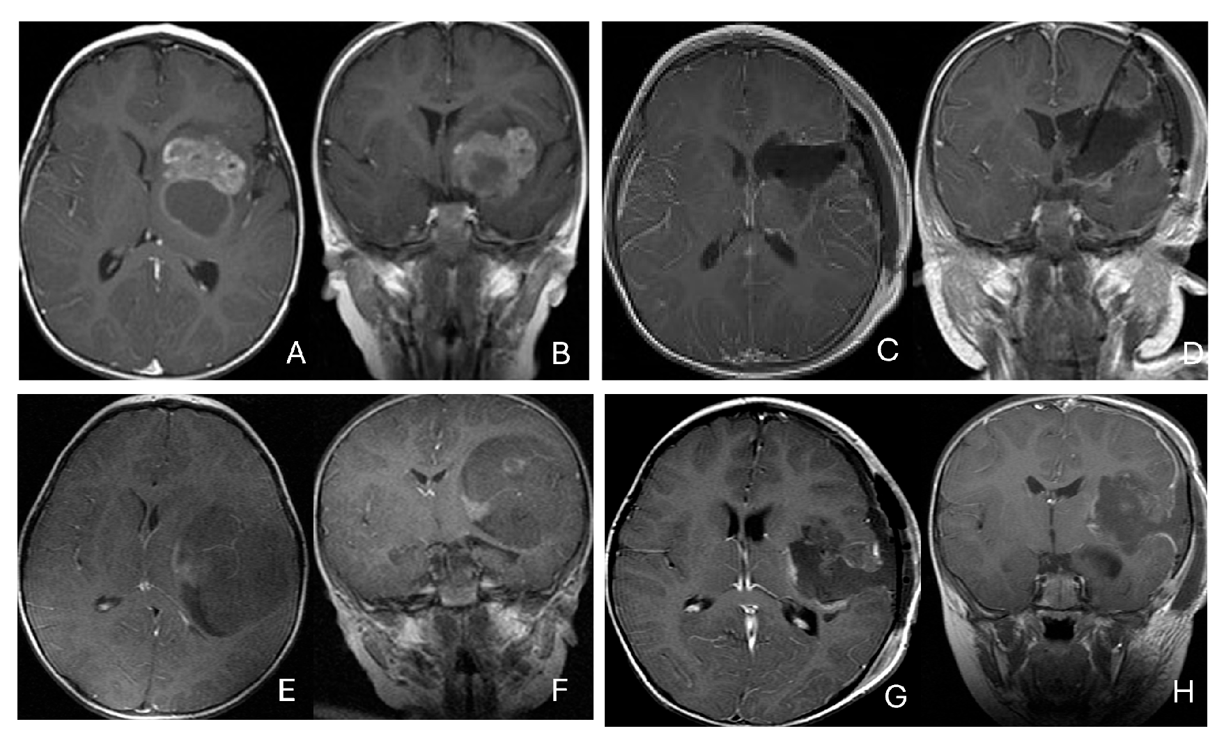 Cancers 18 00008 g003