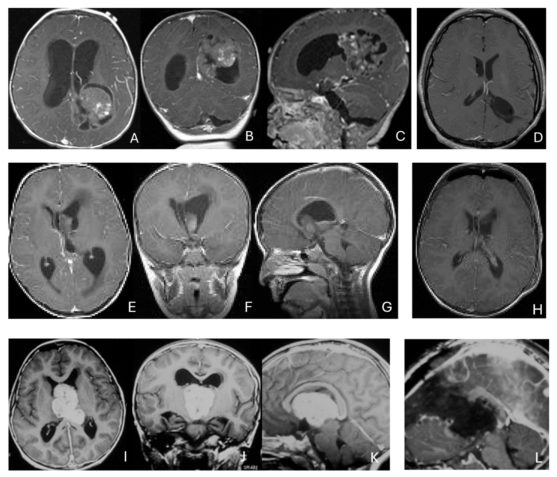 Cancers 18 00008 g004