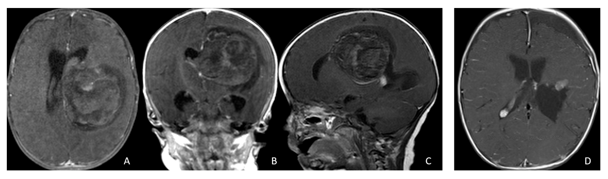 Cancers 18 00008 g005