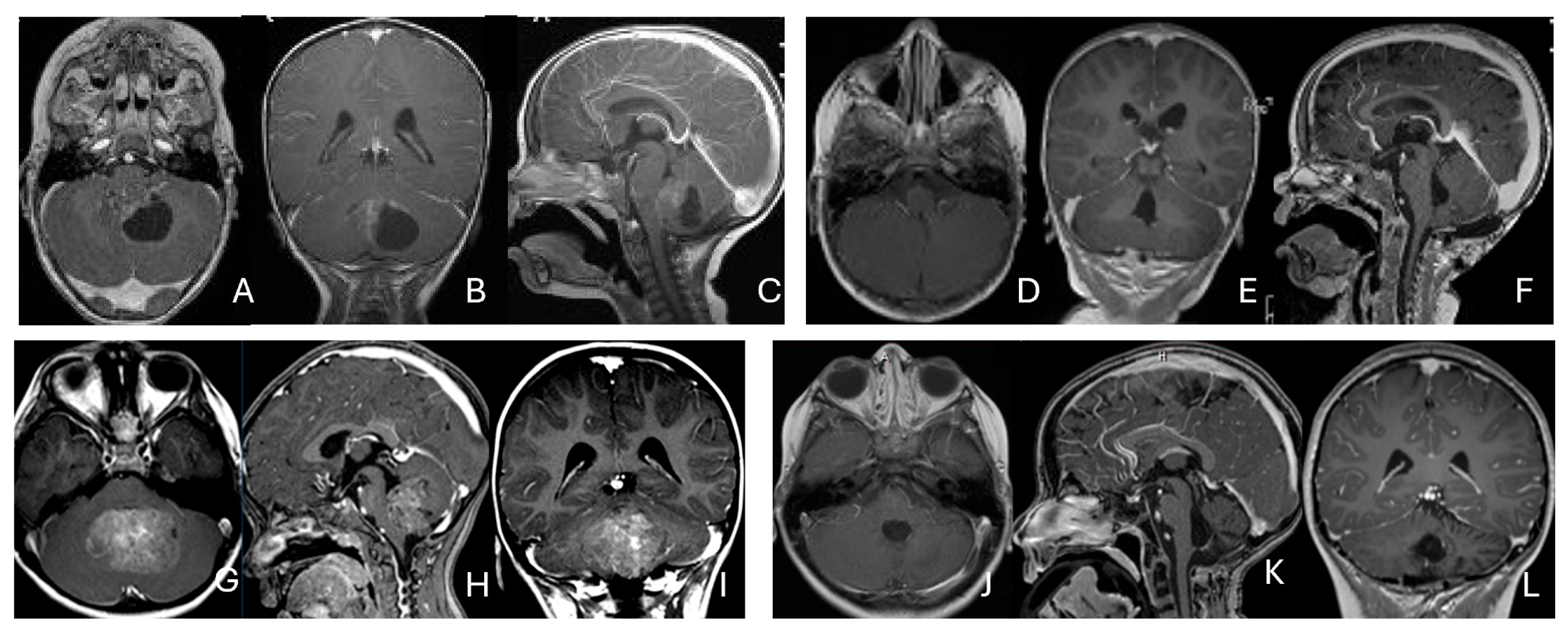 Cancers 18 00008 g007