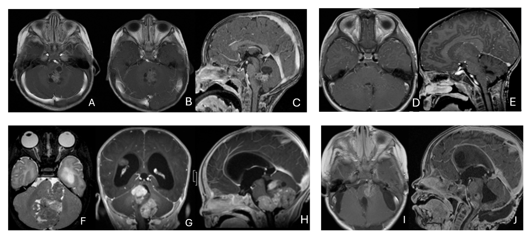 Cancers 18 00008 g008