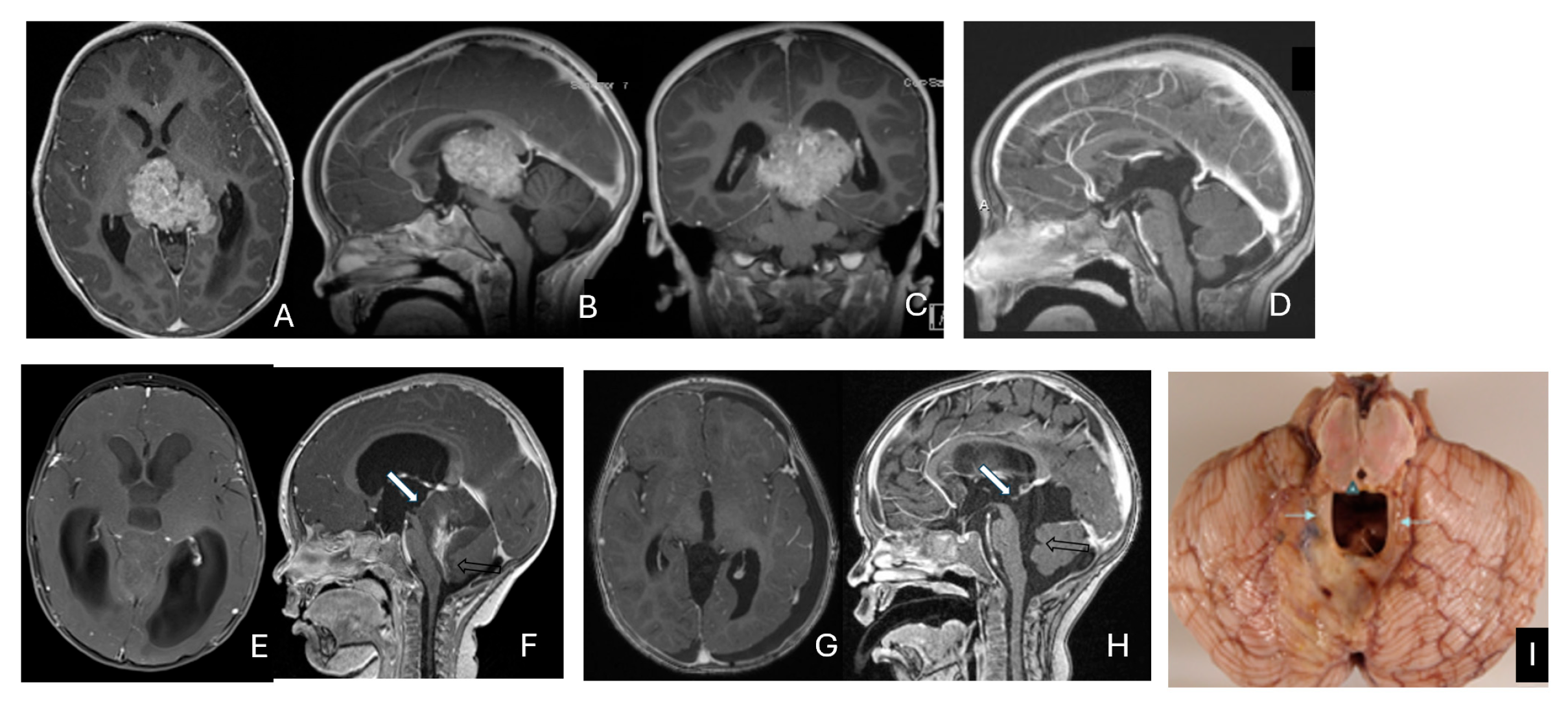 Cancers 18 00008 g010