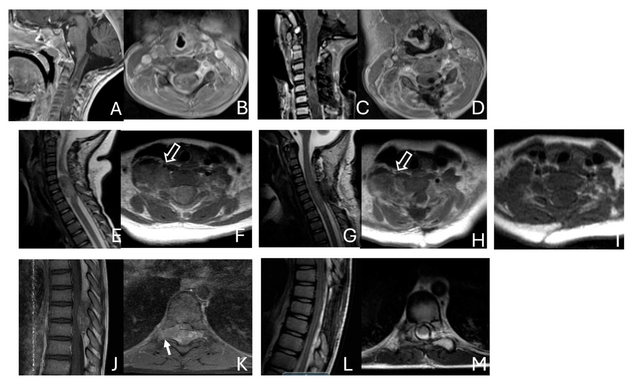 Cancers 18 00008 g011