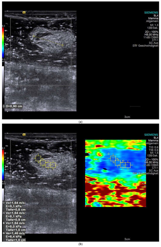 Cancers 18 00183 g001