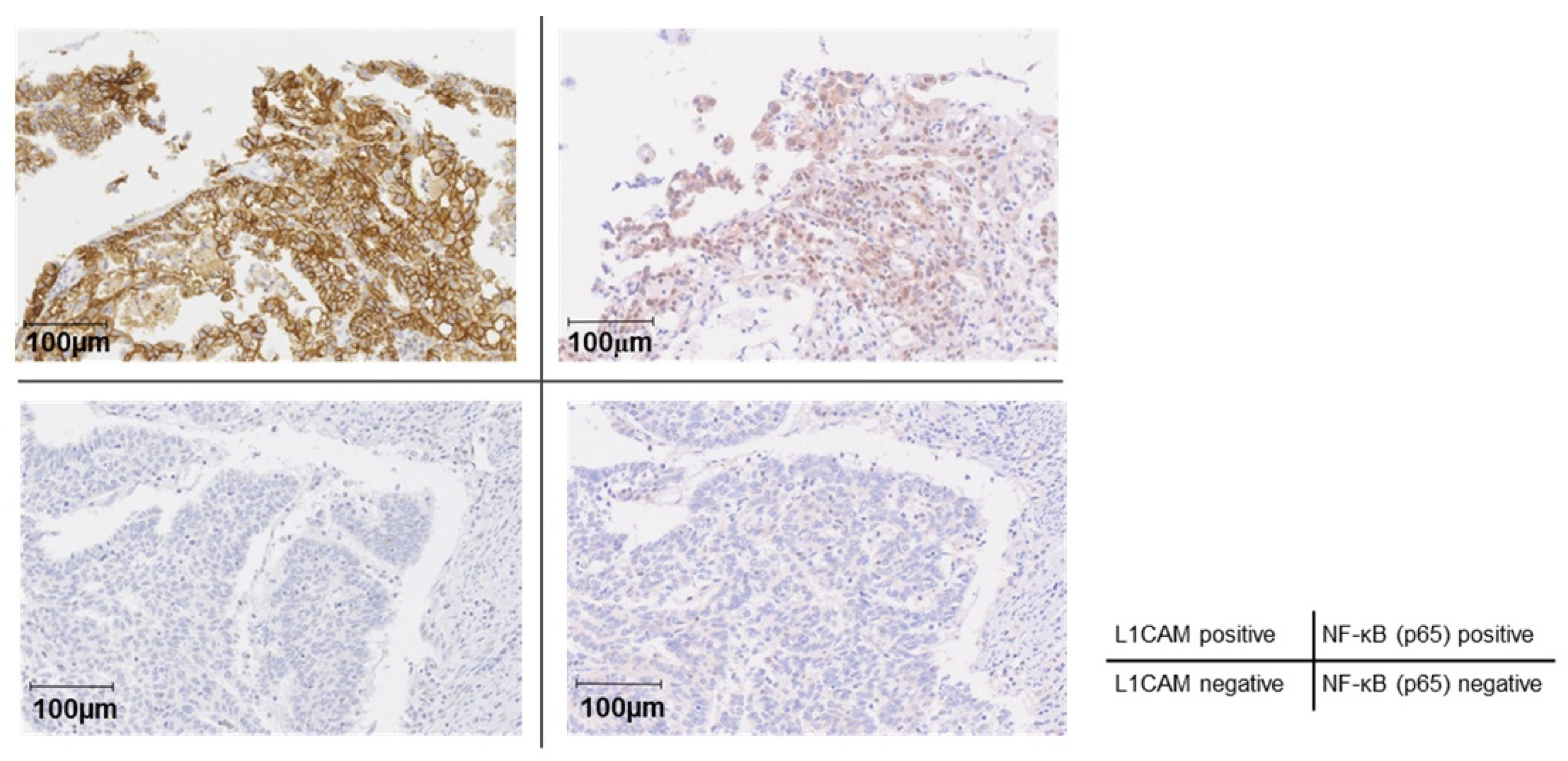 Cancers 18 00198 g007