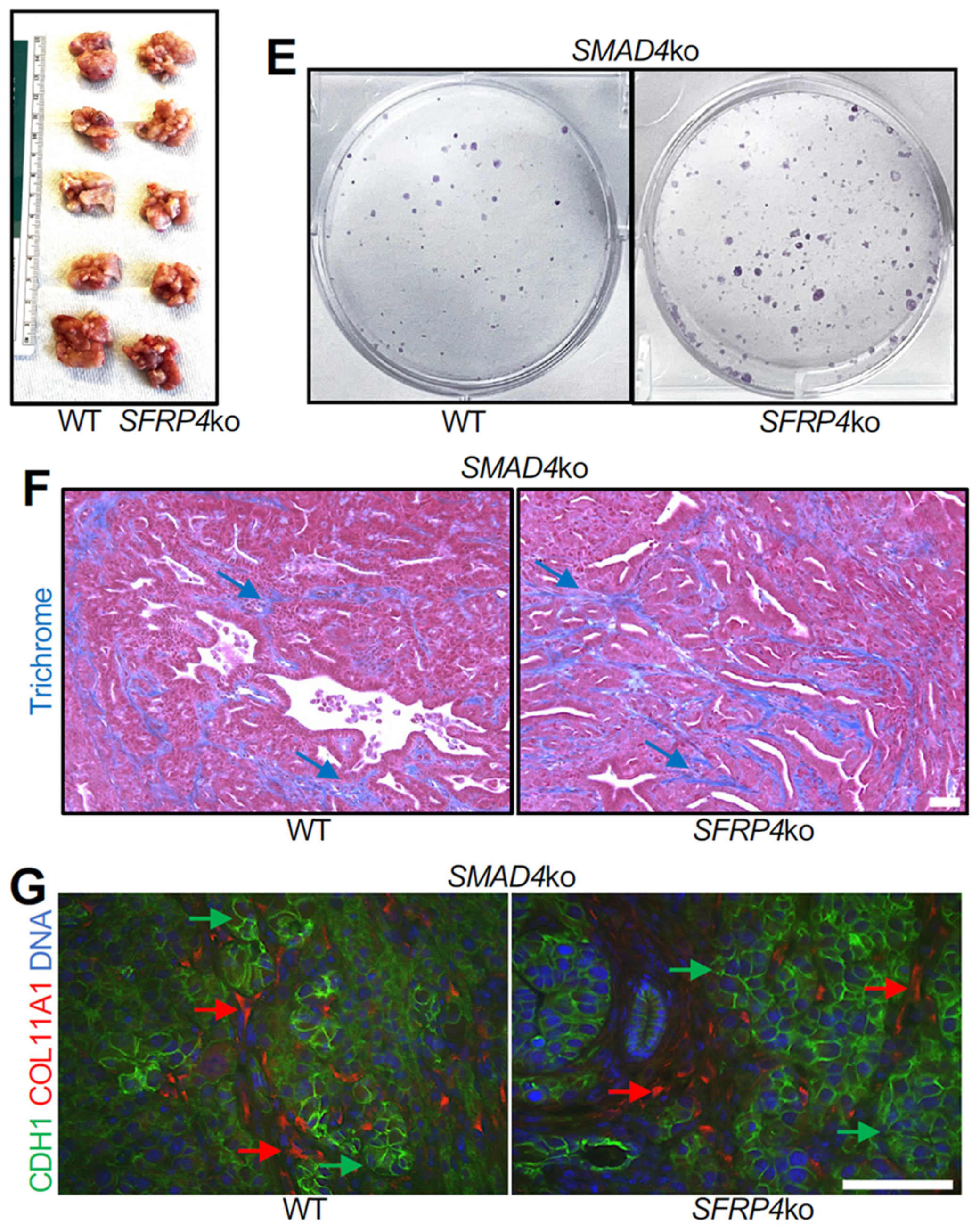 Cancers 18 00233 g005b