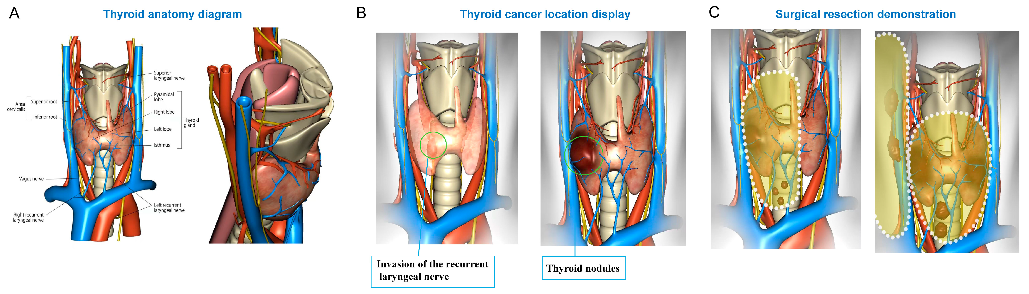 Cancers 18 00241 g002