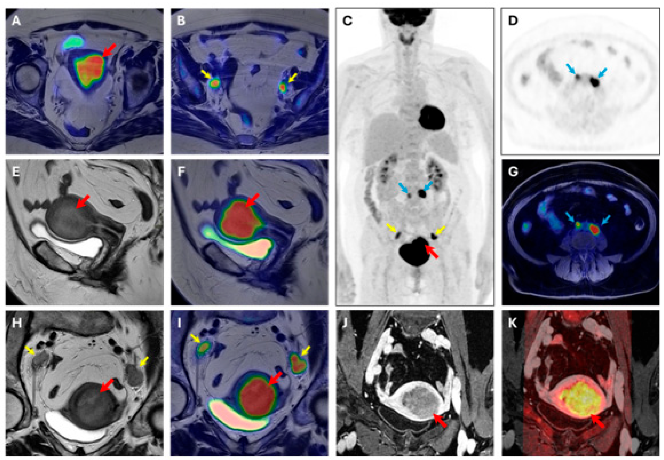 Cancers 18 00280 g003