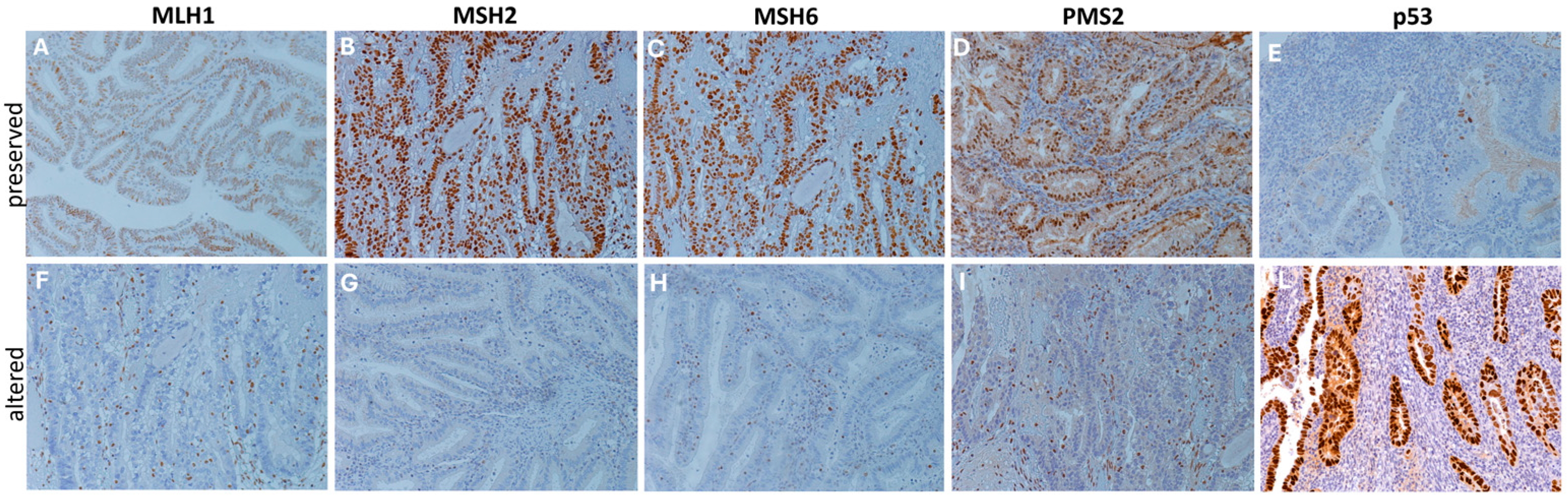 Cancers 18 00280 g005