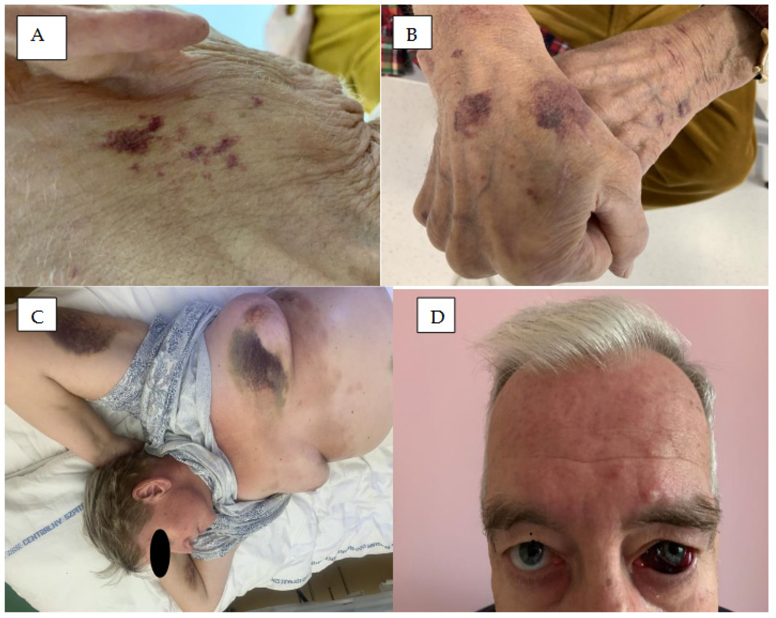 Cancers 18 00371 g001