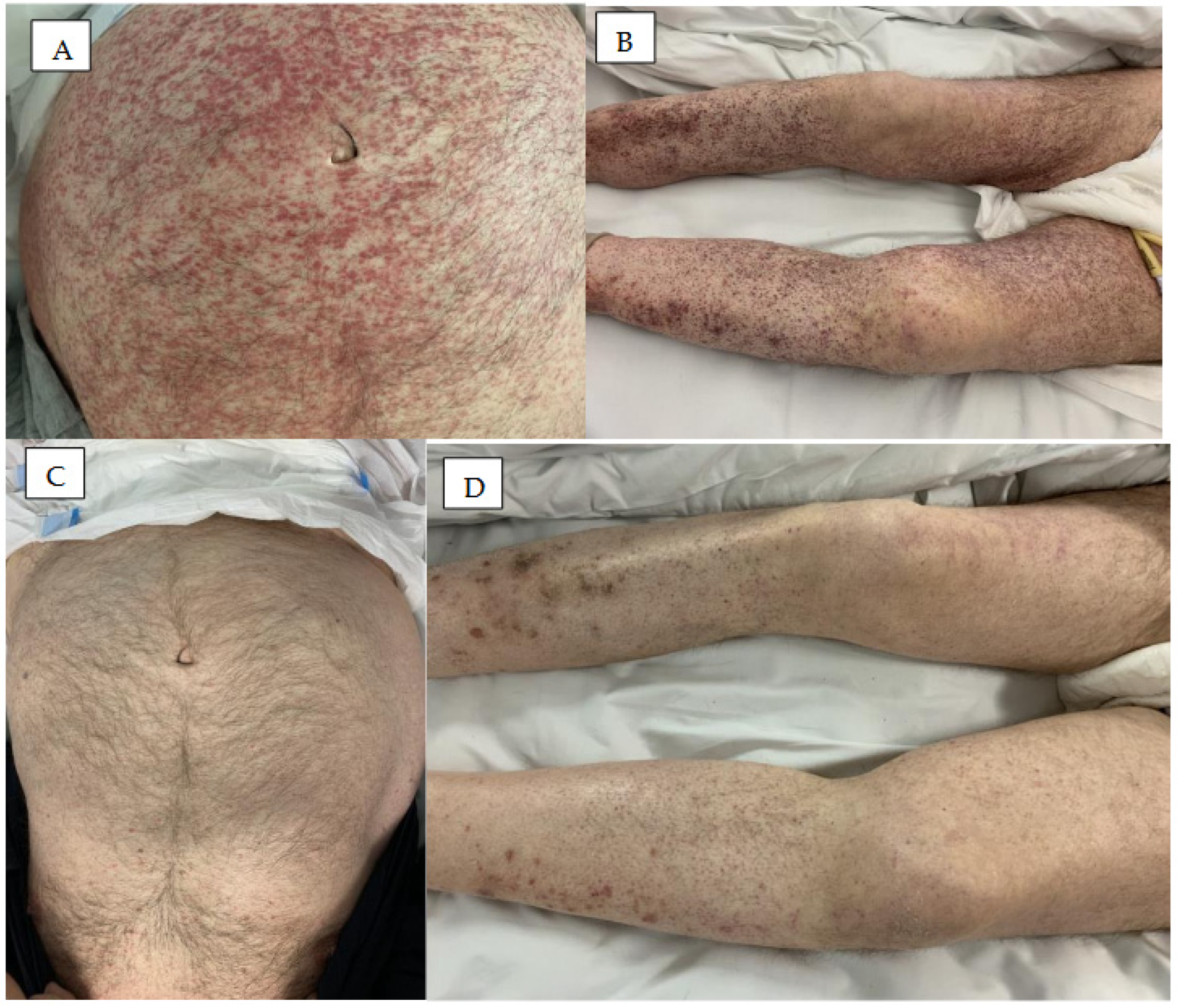 Cancers 18 00371 g002