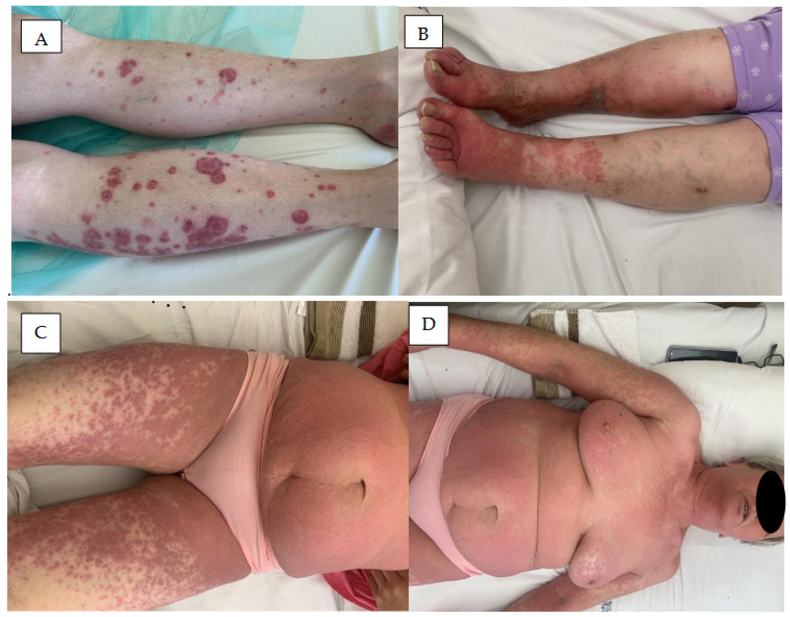 Cancers 18 00371 g003