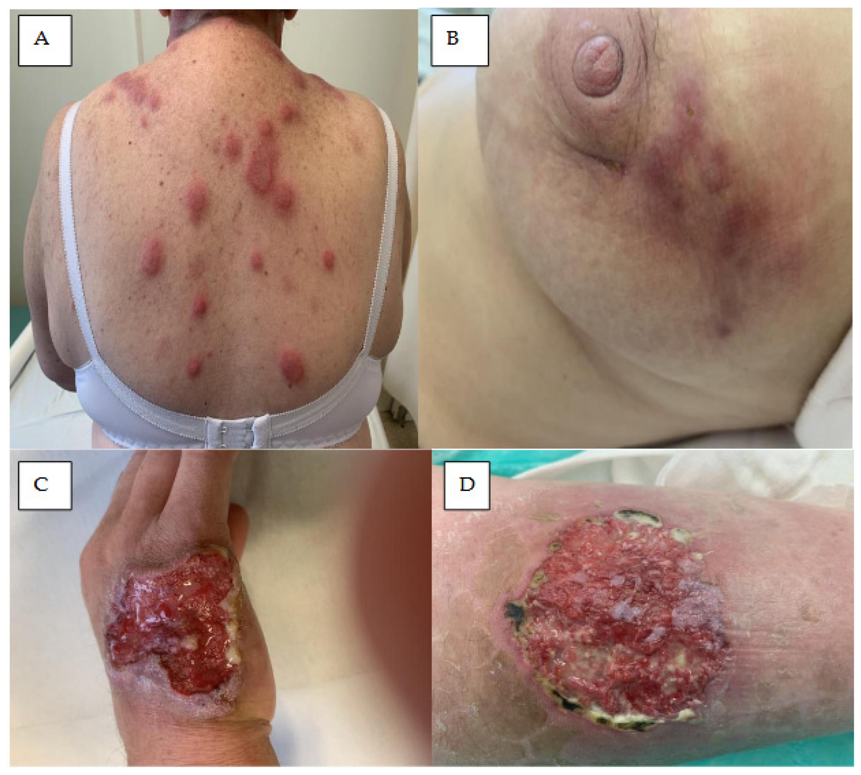 Cancers 18 00371 g004