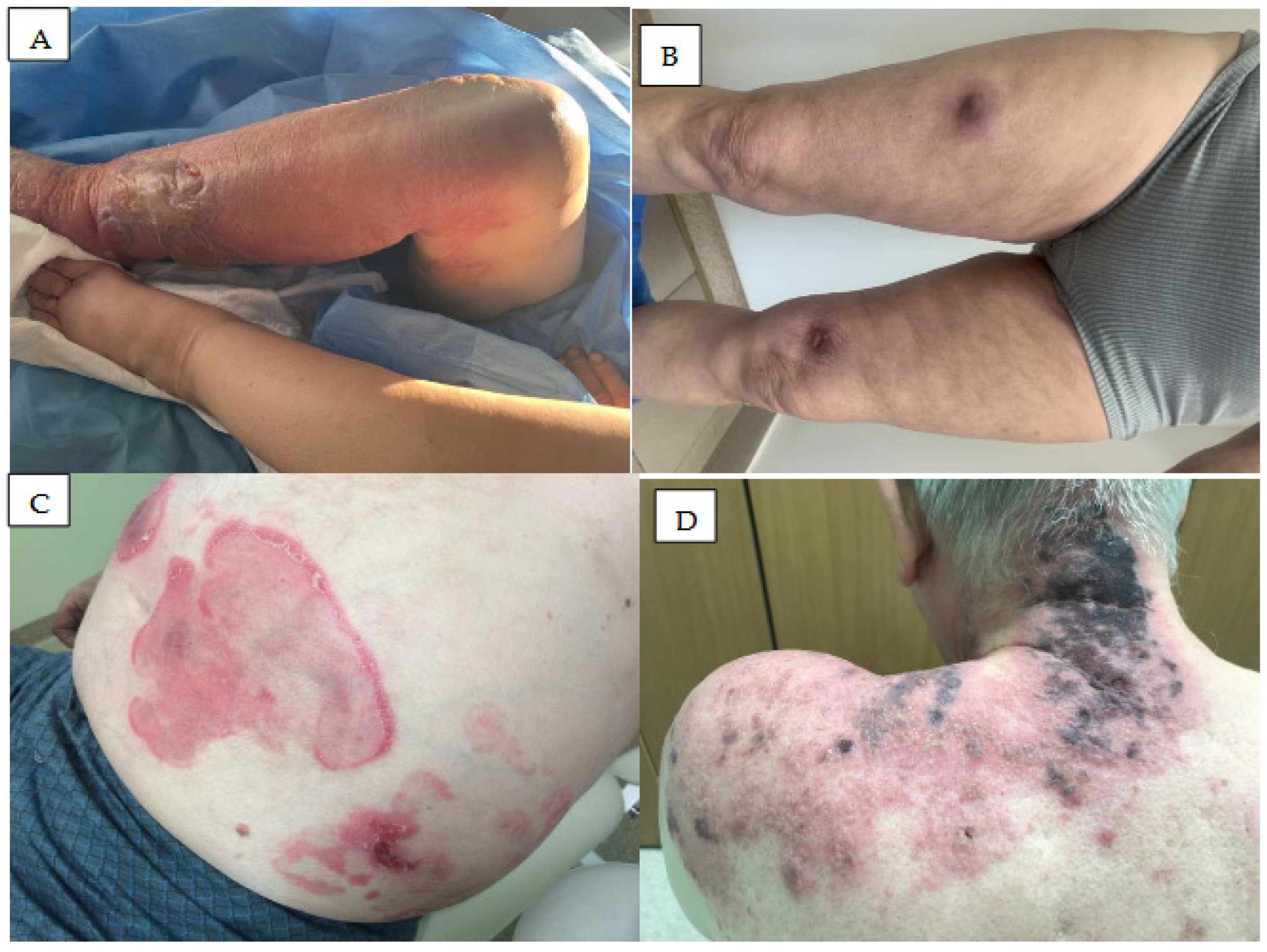 Cancers 18 00371 g005