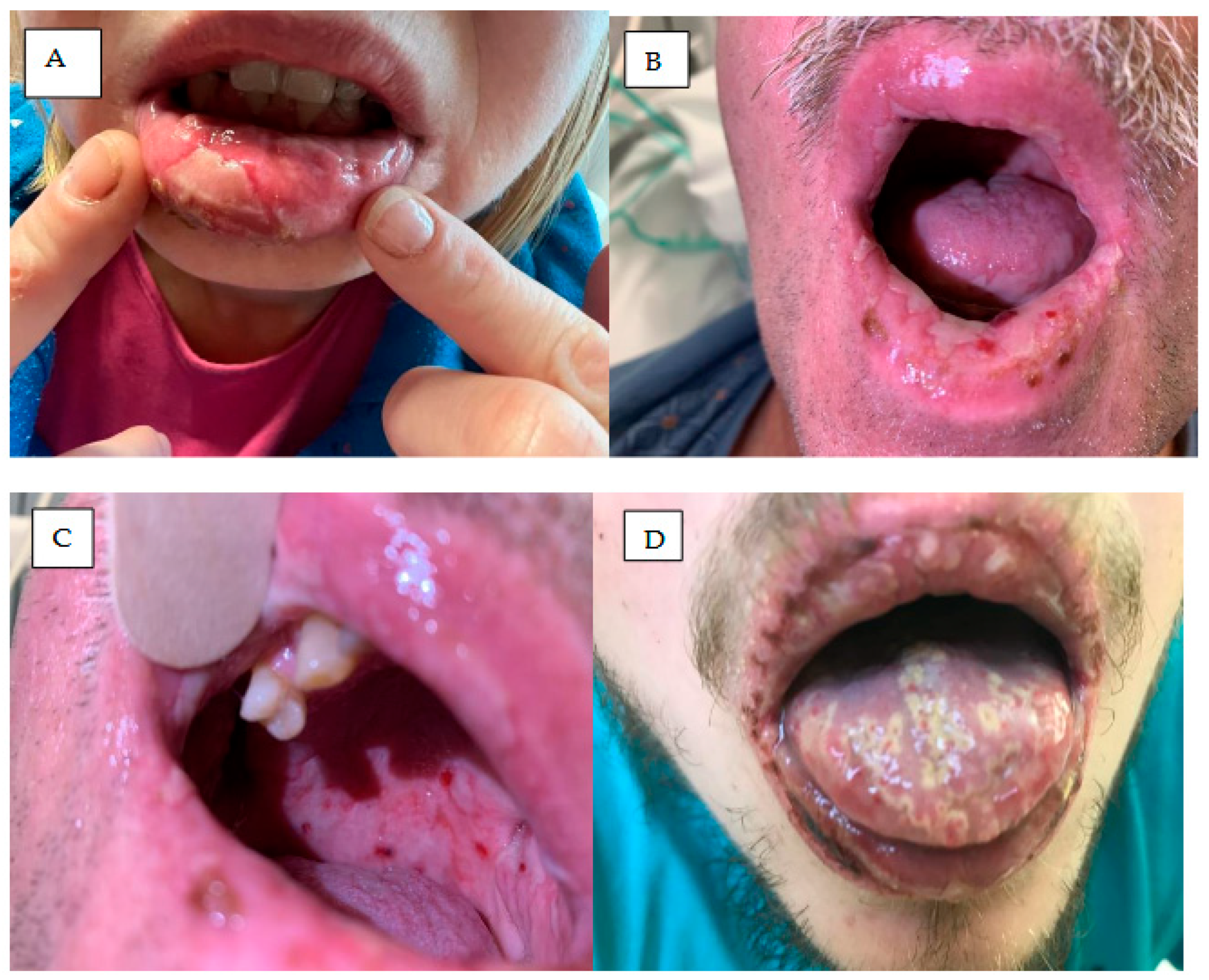 Cancers 18 00371 g006