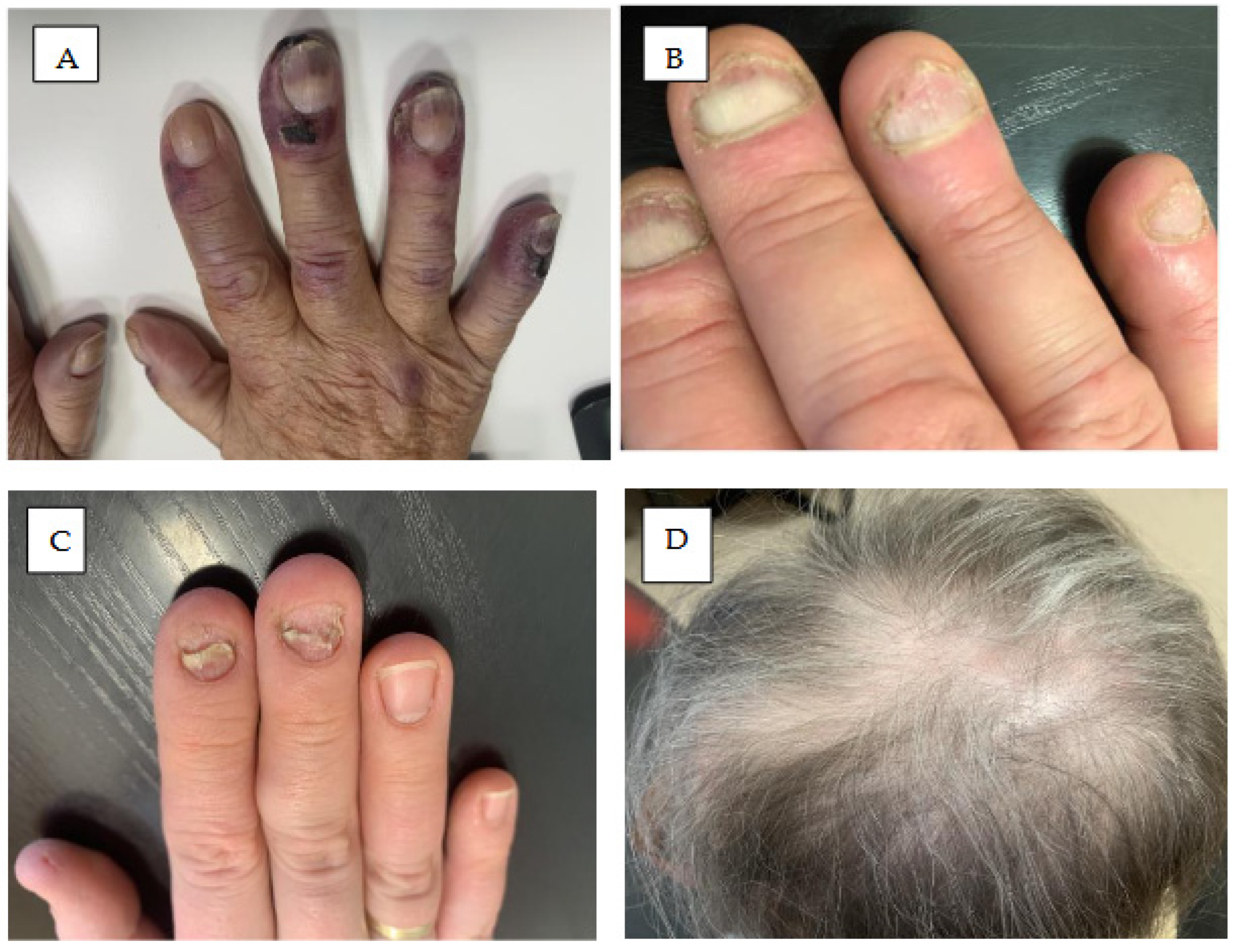 Cancers 18 00371 g007