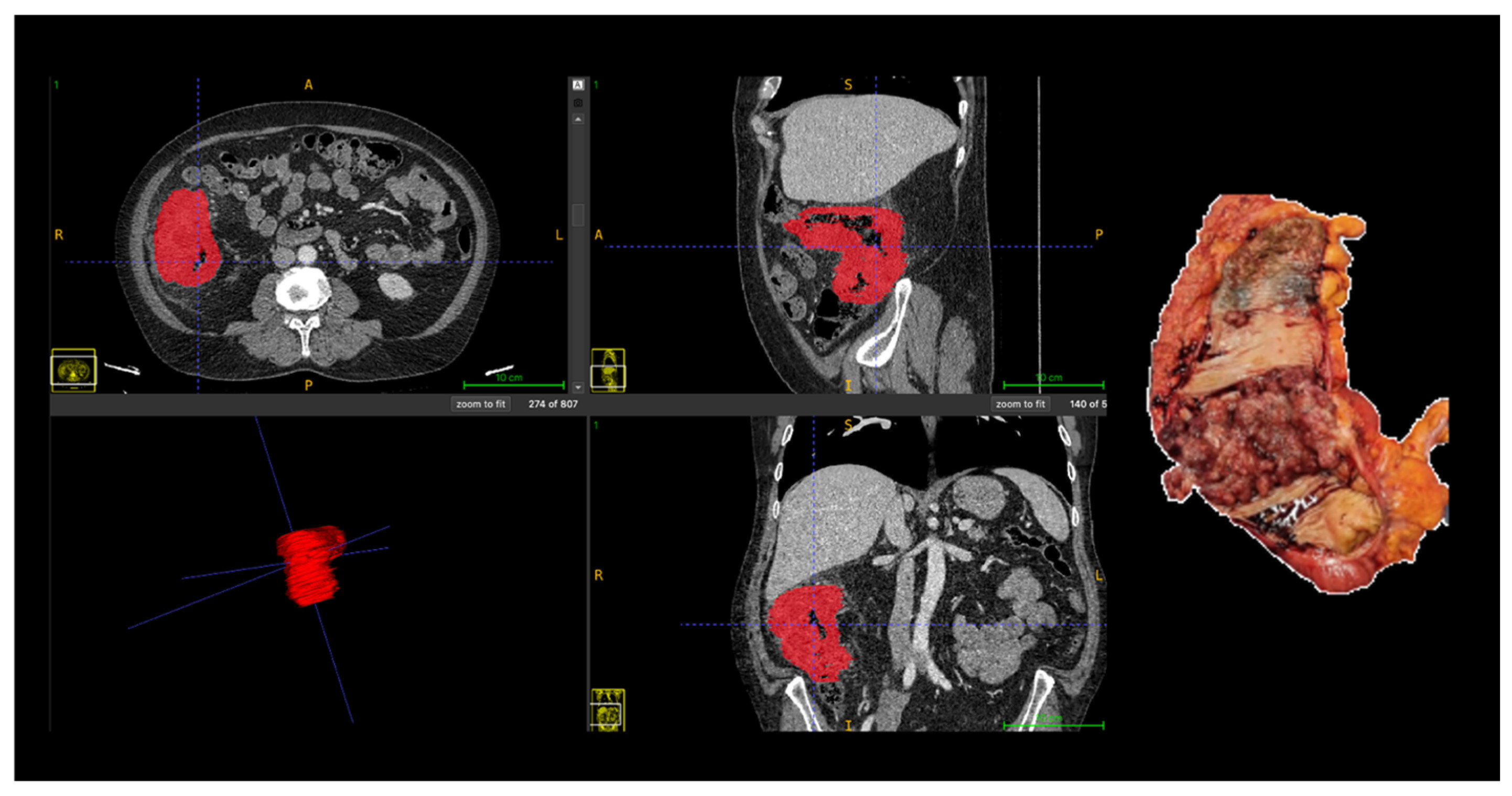 Cancers 18 00377 g001