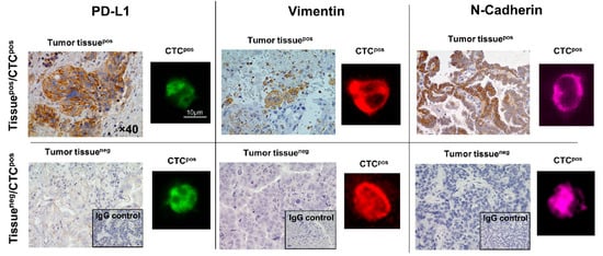 Cancers 18 00391 g004