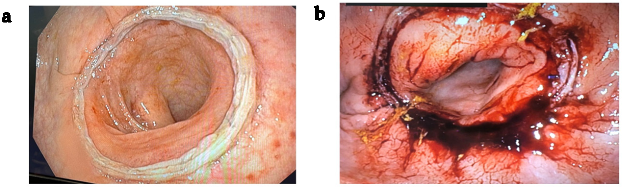 Cancers 18 00400 g003 Cancers 18 00400 g003
