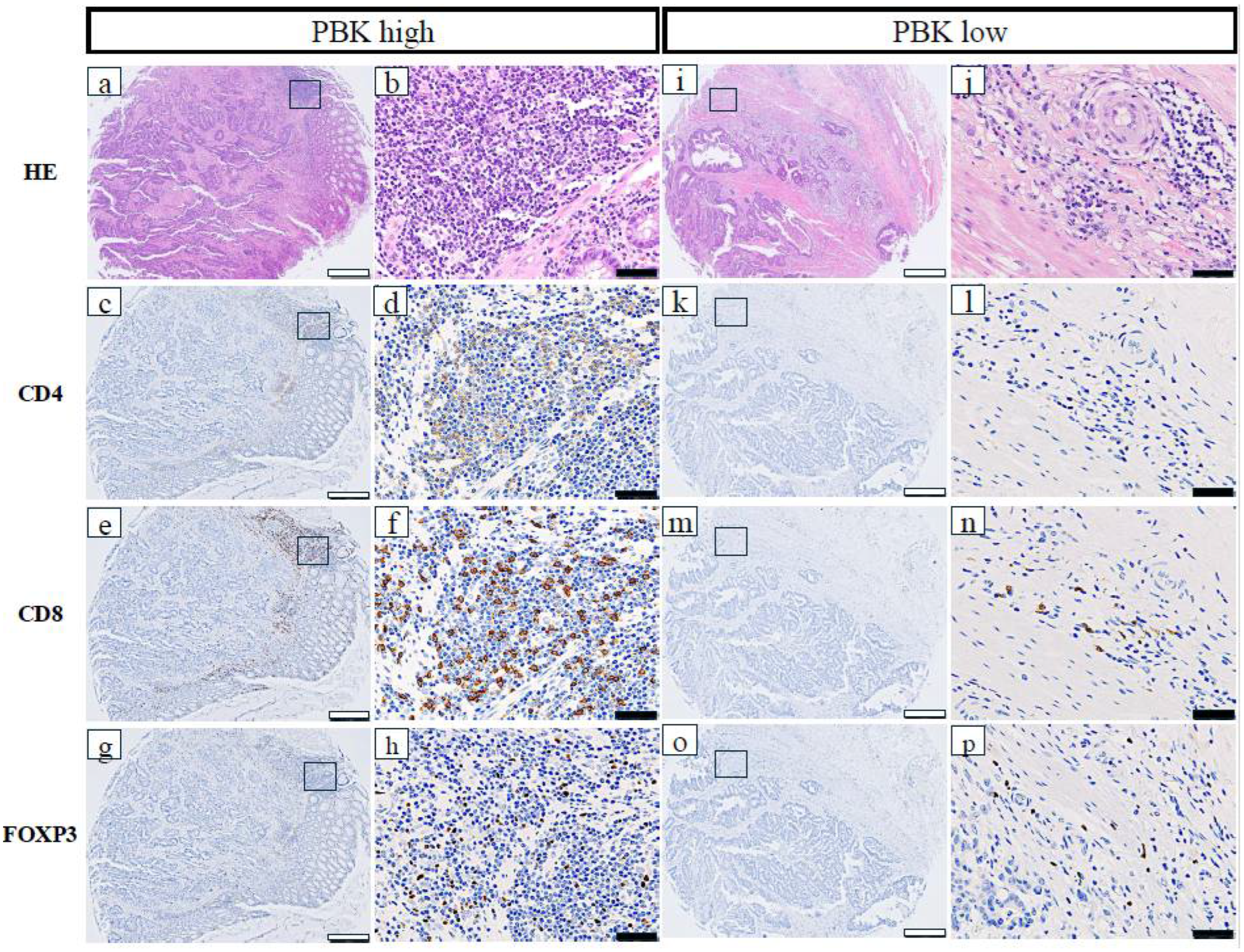 Cancers 18 00482 g002 Cancers 18 00482 g002