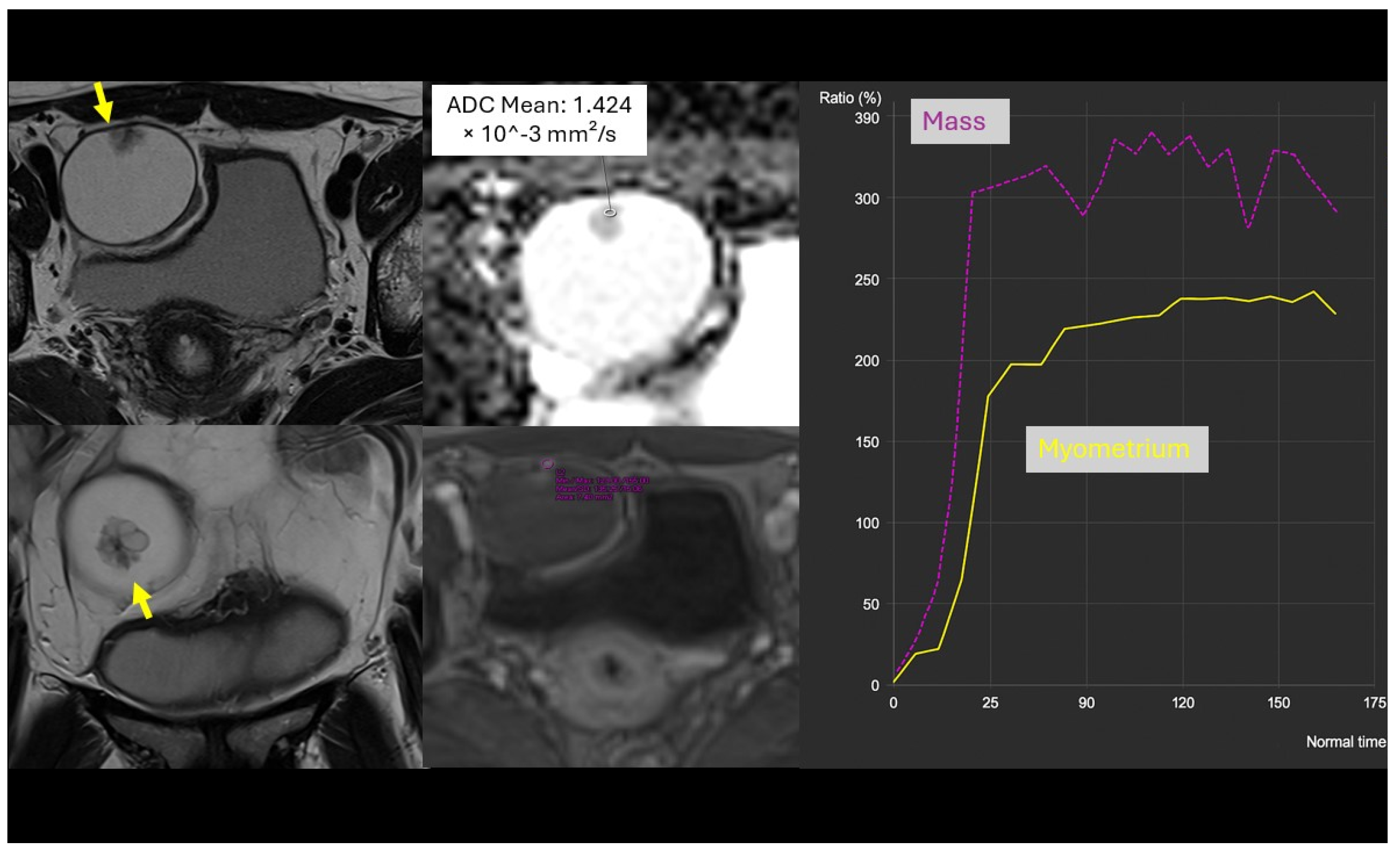 Cancers 18 00516 g003