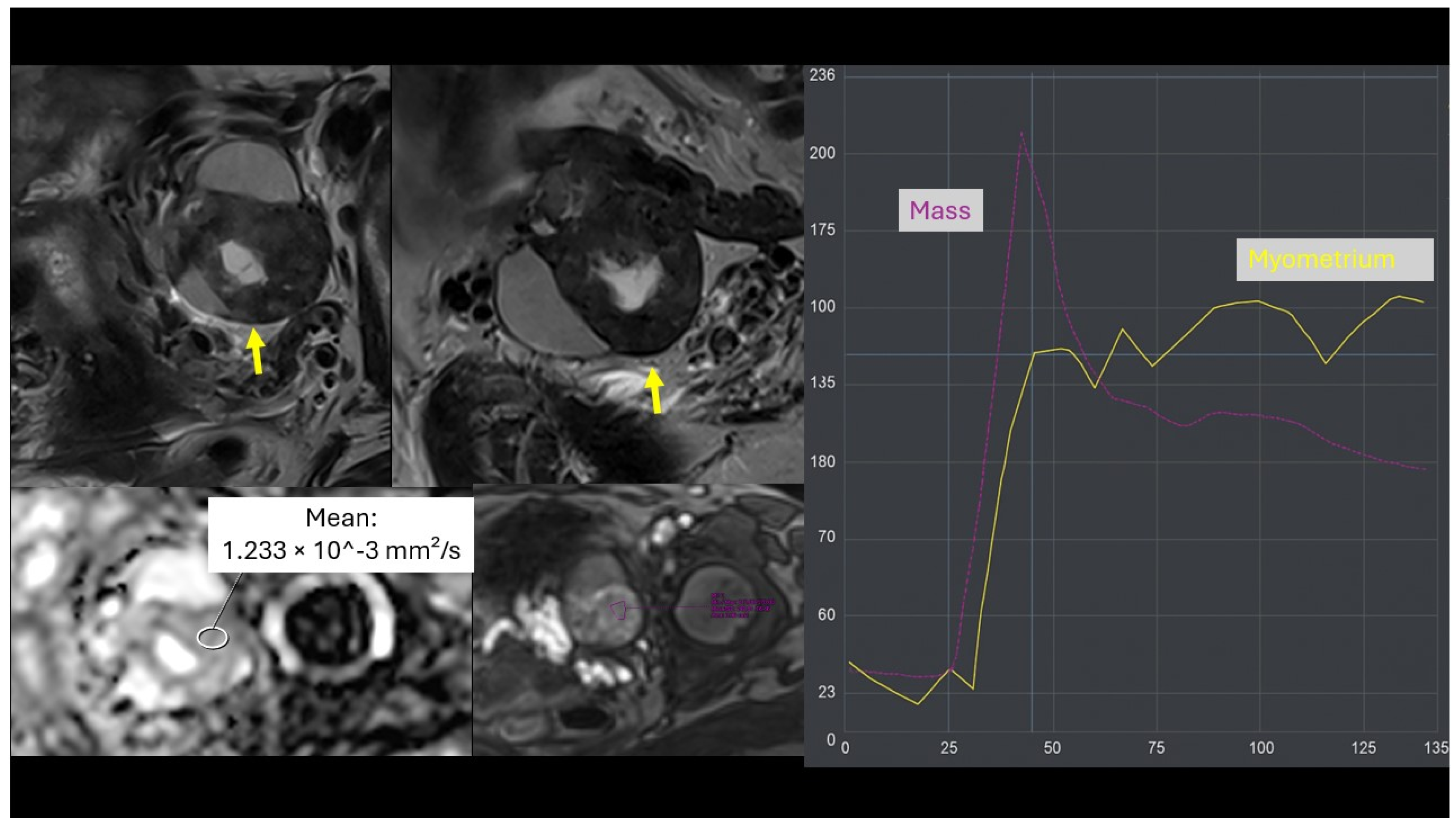Cancers 18 00516 g005