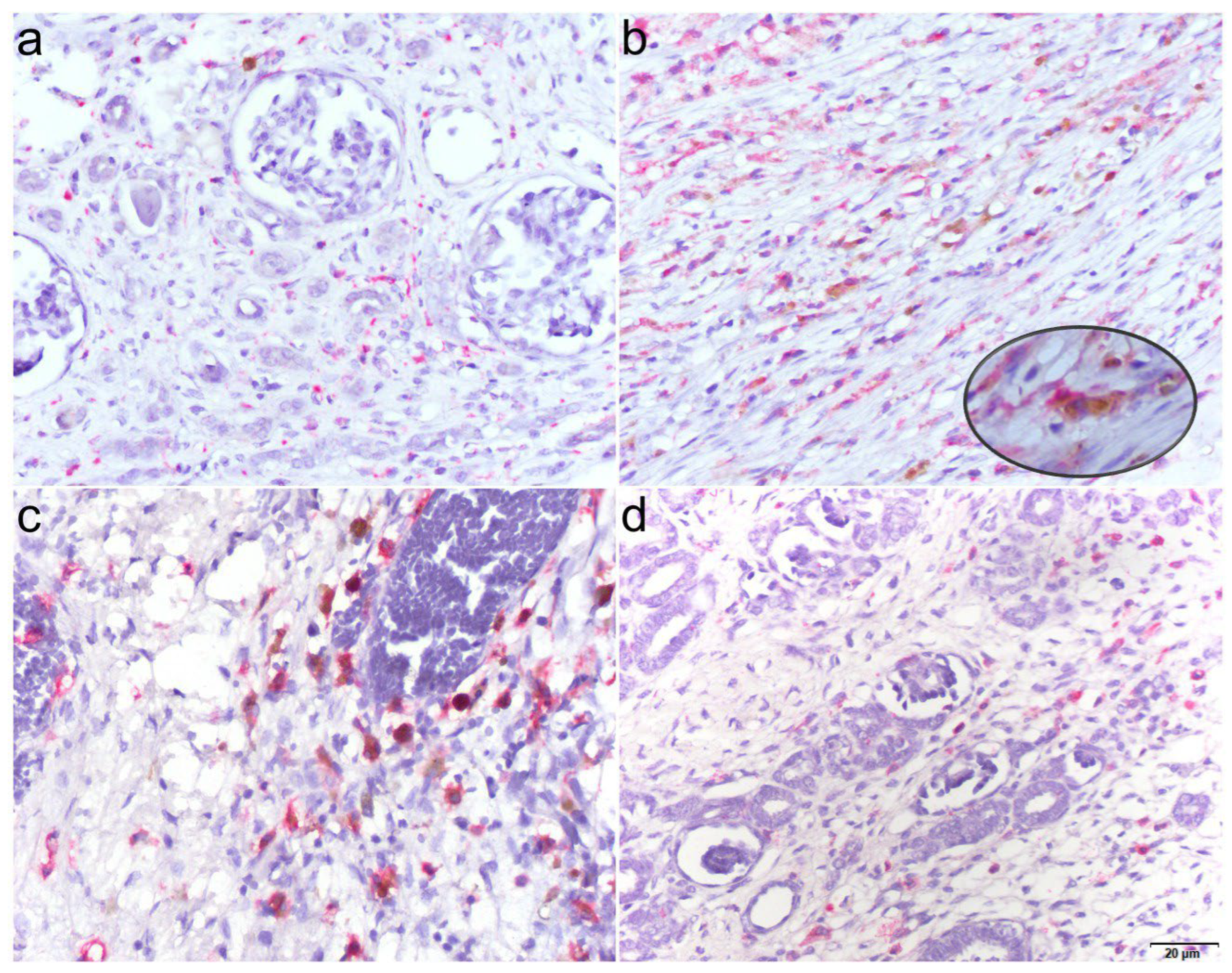 Cancers 18 00810 g002