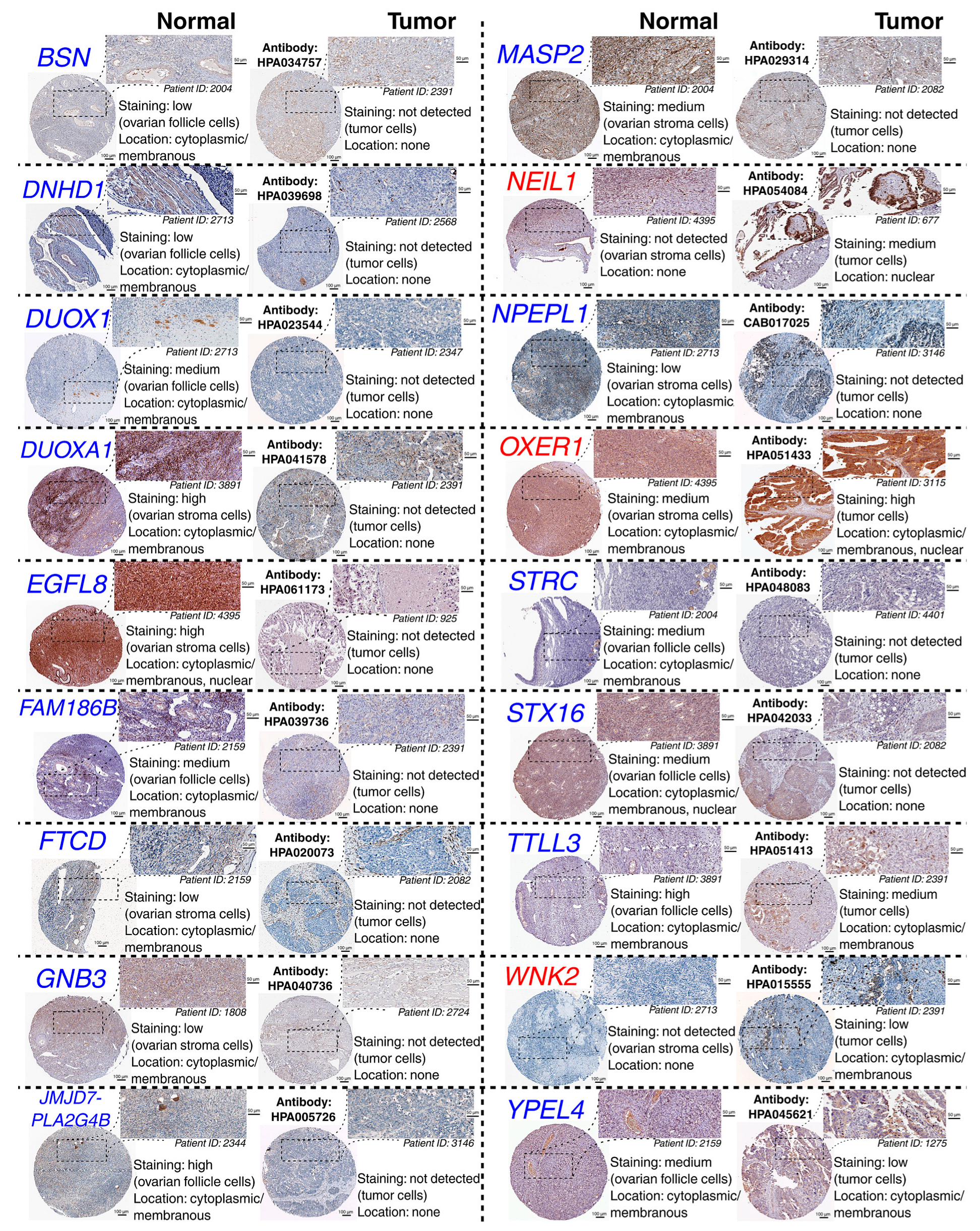 Cancers 18 03168 g005 Cancers 18 03168 g005