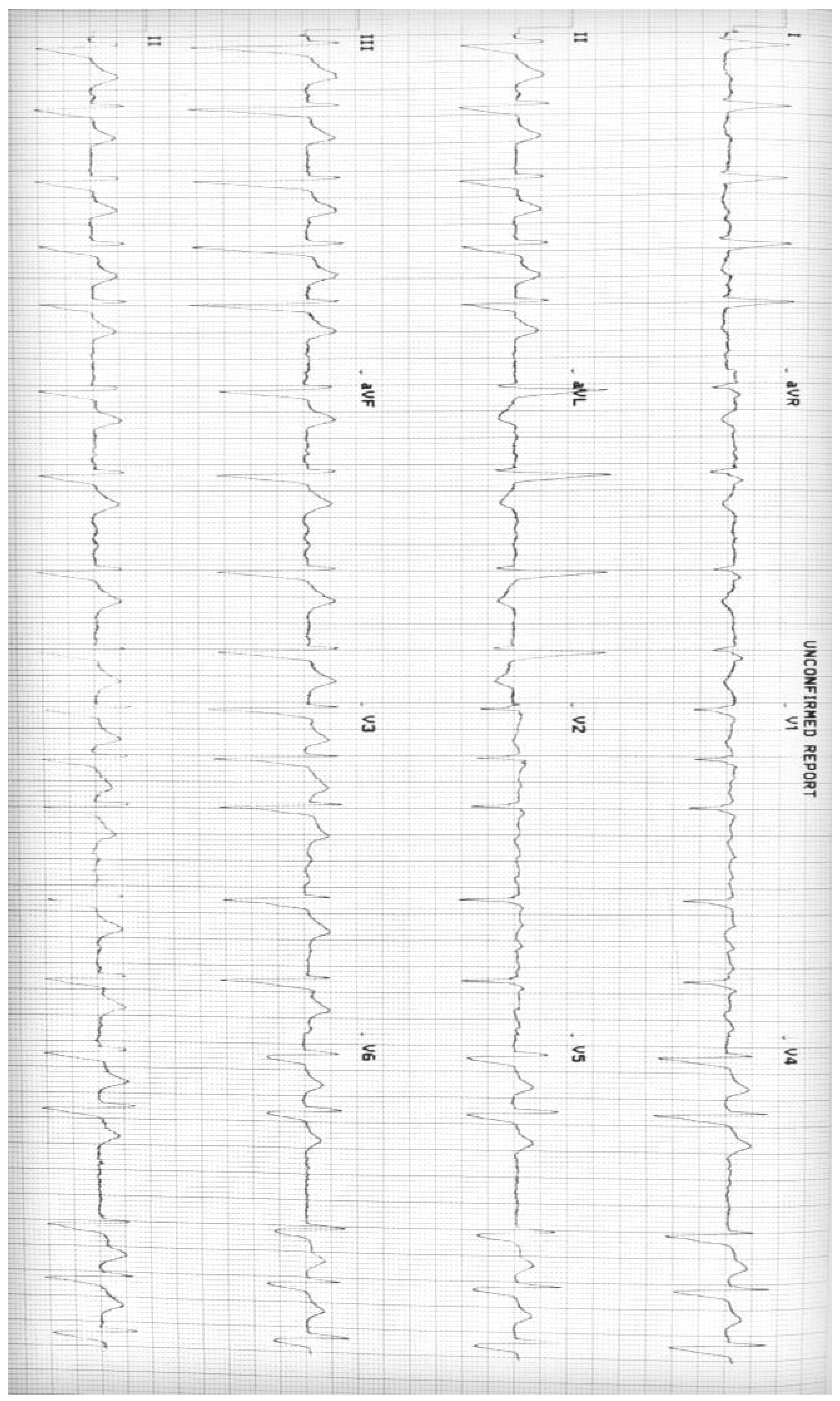 Cardiogenetics 10 00006 g001 Cardiogenetics 10 00006 g001