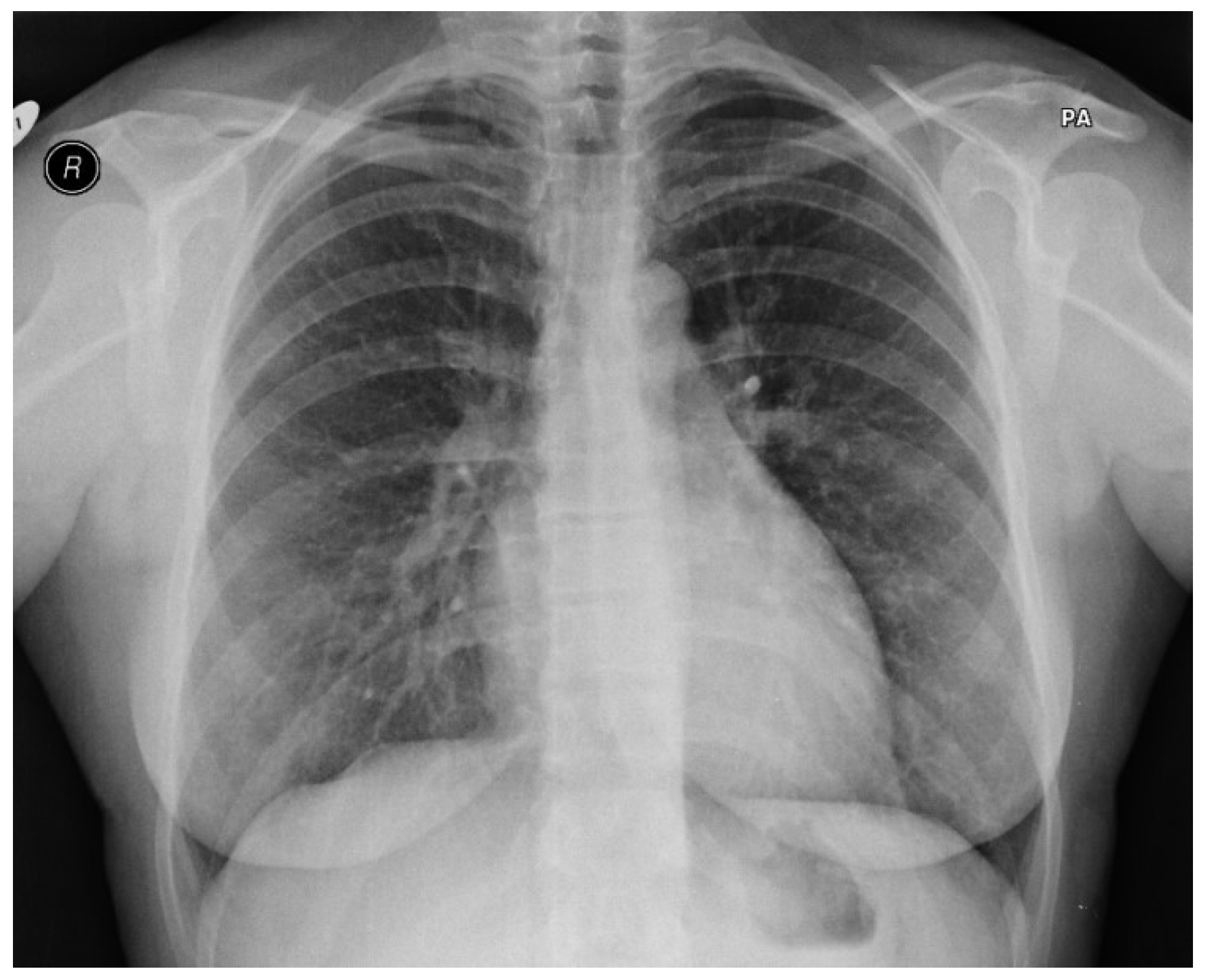 Cardiogenetics 10 00006 g002 Cardiogenetics 10 00006 g002