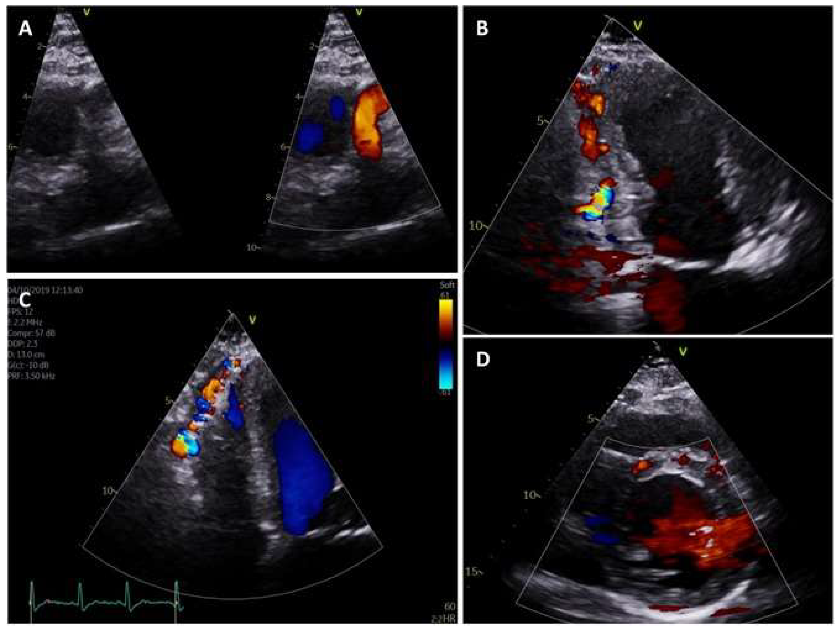 Cardiogenetics 10 00006 g003 Cardiogenetics 10 00006 g003