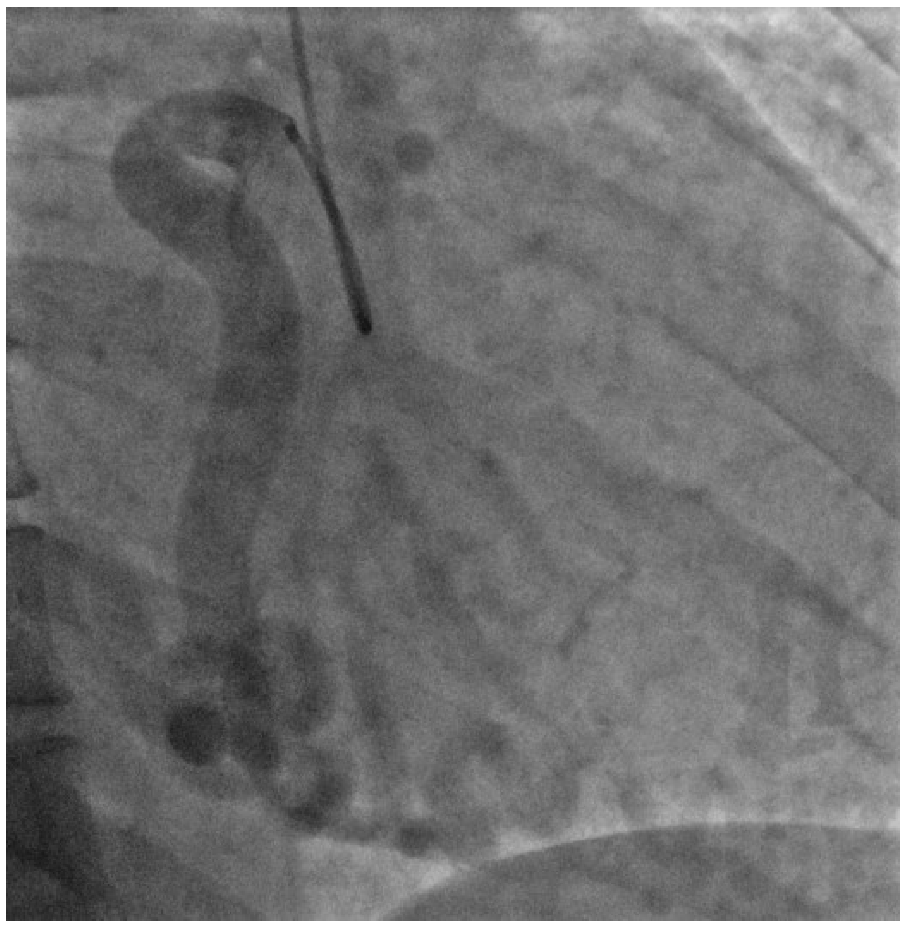 Cardiogenetics 10 00006 g004 Cardiogenetics 10 00006 g004