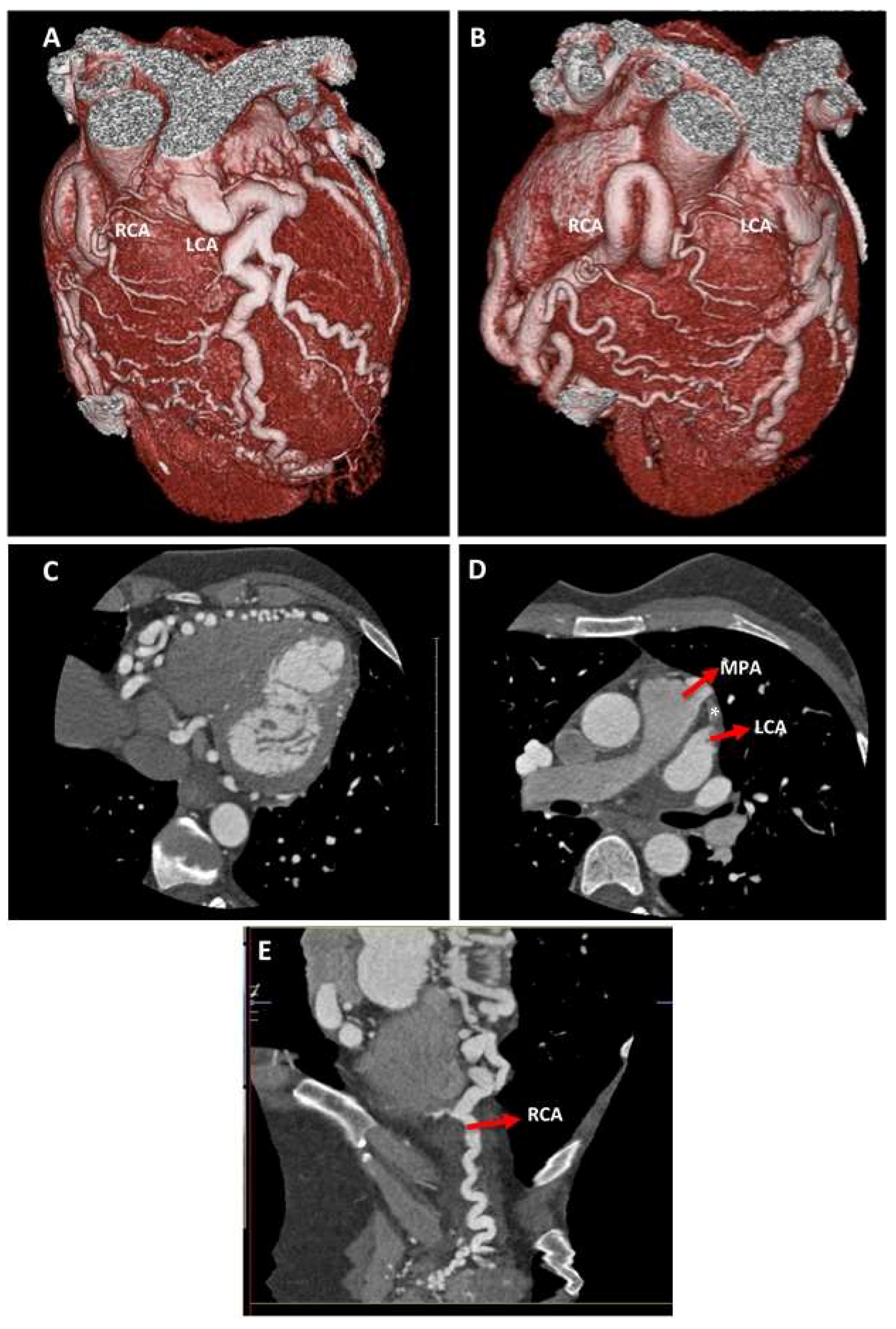 Cardiogenetics 10 00006 g005 Cardiogenetics 10 00006 g005